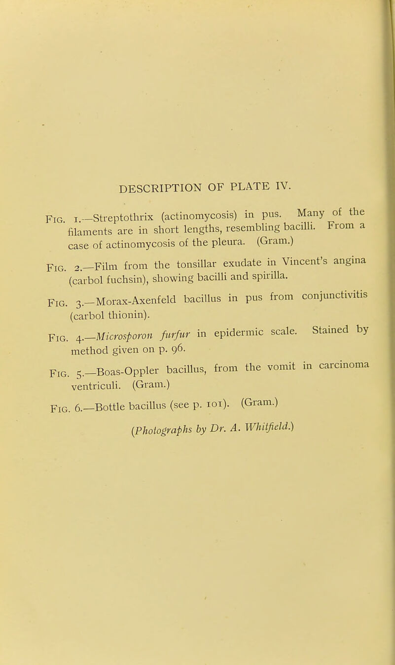 Fig I —Streptothrix (actinomycosis) in pus. Many of the filaments are in short lengths, resembling bacilli. From a case of actinomycosis of the plem-a. (Gram.) Fig. 2.—Film from the tonsillar exudate in Vincent's angina (carbol fuchsin), showing bacilli and spirilla. Fig. 3.-Morax-Axenfeld bacillus in pus from conjunctivitis (carbol thionin). Fig. ^.-Microsporon furfur in epidermic scale. Stained by method given on p. 96. Fig. 5.-Boas-Oppler bacillus, from the vomit in carcinoma ventriculi. (Gram.) Fig. 6.—Bottle bacillus (see p. loi). (Gram.) {Photographs by Dr. A. Whitfield.)