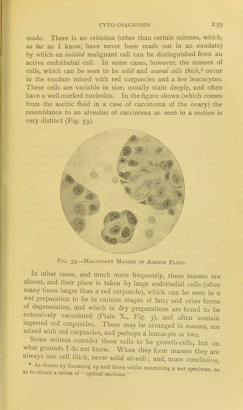 made. There is no criterion (other than certain mitoses, which, as far as I know, have never been made out in an exudate) by which an isolated malignant cell can be distinguished from an active endothelial cell. In some cases, however, the masses of cells, which can be seen to be solid and several cells thick,^' occur in the exudate mixed with red corpuscles and a few leucocytes. These cells are variable in size, usually stain deeply, and often have a well marked nucleolus. In the figure shown (which comes from the ascitic fluid in a case of carcinoma of the ovary) the resemblance to an alveolus of carcinoma as seen in a section is very distinct (Fig. 53). Fig- 53-—Malignant Masses in Ascitic Fldid. In other cases, and much more frequently, these masses are absent, and their place is taken by large endothelial cells (often many times larger than a red corpuscle), which can be seen in a wet preparation to be in various stages of fatty and other forms of degeneration, and which in dry preparations are found to be extensively vacuolated (Plate X., Fig. 3), and often contain mgested red corpuscles. These may be arranged in masses, are mixed with red corpuscles, and perhaps a leucocyte or two. Some writers consider these cells to be growth-cells, but on what grounds I do not know. When they form masses they are always one cell thick, never solid alveoli; and, more conclusive
