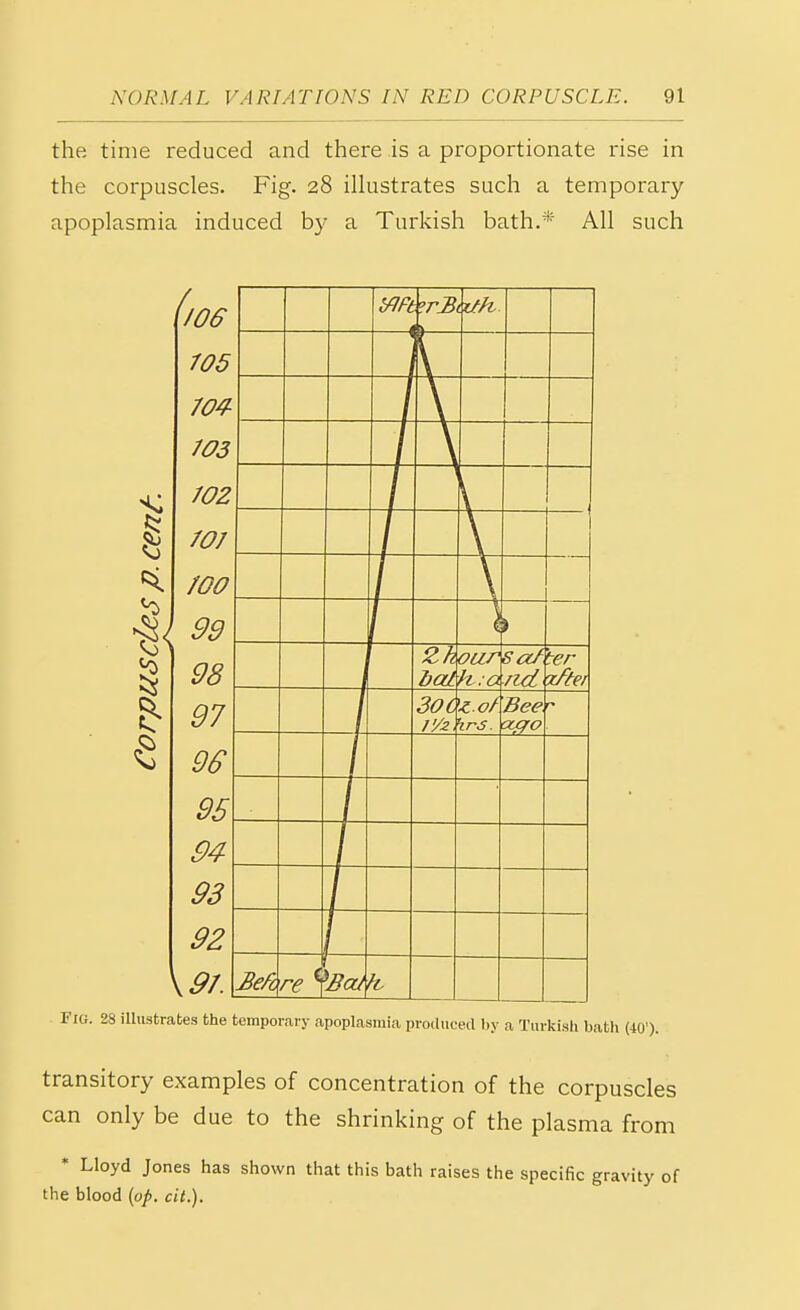 the time reduced and there is a proportionate rise in the corpuscles. Fig. 28 illustrates such a temporary apoplasmia induced by a Turkish bath.* All such / 70S 705 lU'r 703 70Z * KS £-1 707 Qq JJ Jo J 7 % 95 94 93 92 \9I. Wft 1 t3 r v -A Zh bat oar tt.a Sa7 /id 'ter %/tei 30C 11/2 zo7 irS. Bee f re<\ Bed Fig. 23 illustrates the temporary apoplasmia produced by a Turkish batli (40'). transitory examples of concentration of the corpuscles can only be due to the shrinking of the plasma from * Lloyd Jones has shown that this bath raises the specific gravity of the blood (op. cit.).