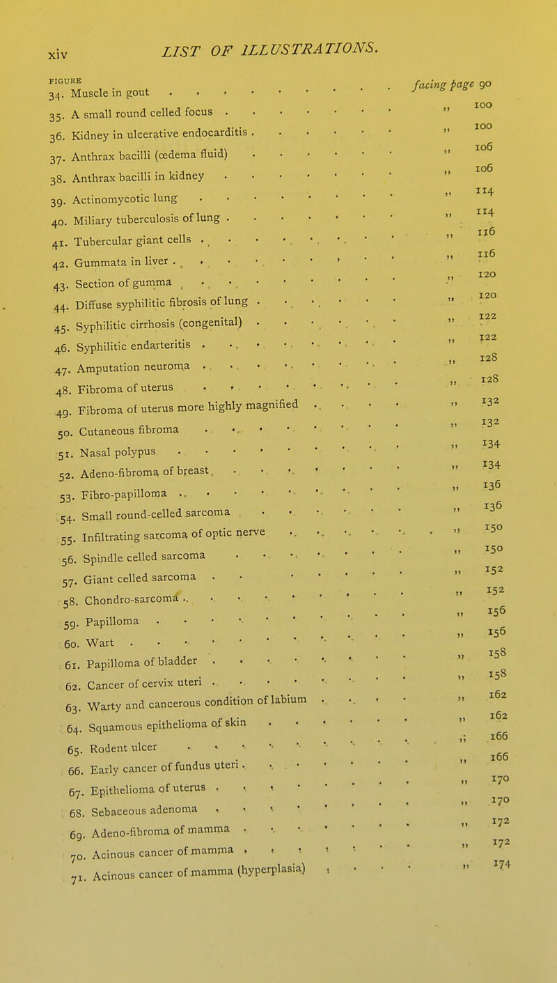 lifted XIV FIGURE 34. Muscle in gout . 35. A small round celled focus . 36. Kidney in ulcerative endocarditis . 37. Anthrax bacilli (oedema fluid) 38. Anthrax bacilli in kidney 39. Actinomycotic lung 40. Miliary tuberculosis of lung . 41. Tubercular giant cells 42. Gummata in liver 43. Section of gumma ( 44. Diffuse syphilitic fibrosis of lung . 45- Syphilitic cirrhosis (congenital) . 46. Syphilitic endarteritis . ... 47. Amputation neuroma . 48. Fibroma of uterus . • • 49. Fibroma of uterus more highly magni 50. Cutaneous fibroma 51. Nasal polypus . 52. Adeno-fibroma of breast, 53. Fibro-papillorna ., 54. Small round-celled sarcoma .55. Infiltrating sarcoma of optic nerve 56. Spindle celled sarcoma 57. Giant celled sarcoma 58. Chondro-sarcoma .. 5g. Papilloma 60. Wart . 61. Papilloma of bladder 62. Cancer of cervix uteri 63. Warty and cancerous condition of labium 64. Squamous epithelioma of skin 65. Rodent ulcer 66. Early cancer of fundus uteri. 67. Epithelioma of uterus , < 68. Sebaceous adenoma 69. Adeno-fibroma of mamma • 70. Acinous cancer of mamma . 71. Acinous cancer of mamma (hyperplasia) facing f age 90 100 100 106 106 114 114 116 116 120 120 122 122 128 128 132 132 *34 134 136 136 150 150 152 152 156 156 158 158 162 162 166 166 170 170 172 172 1/4