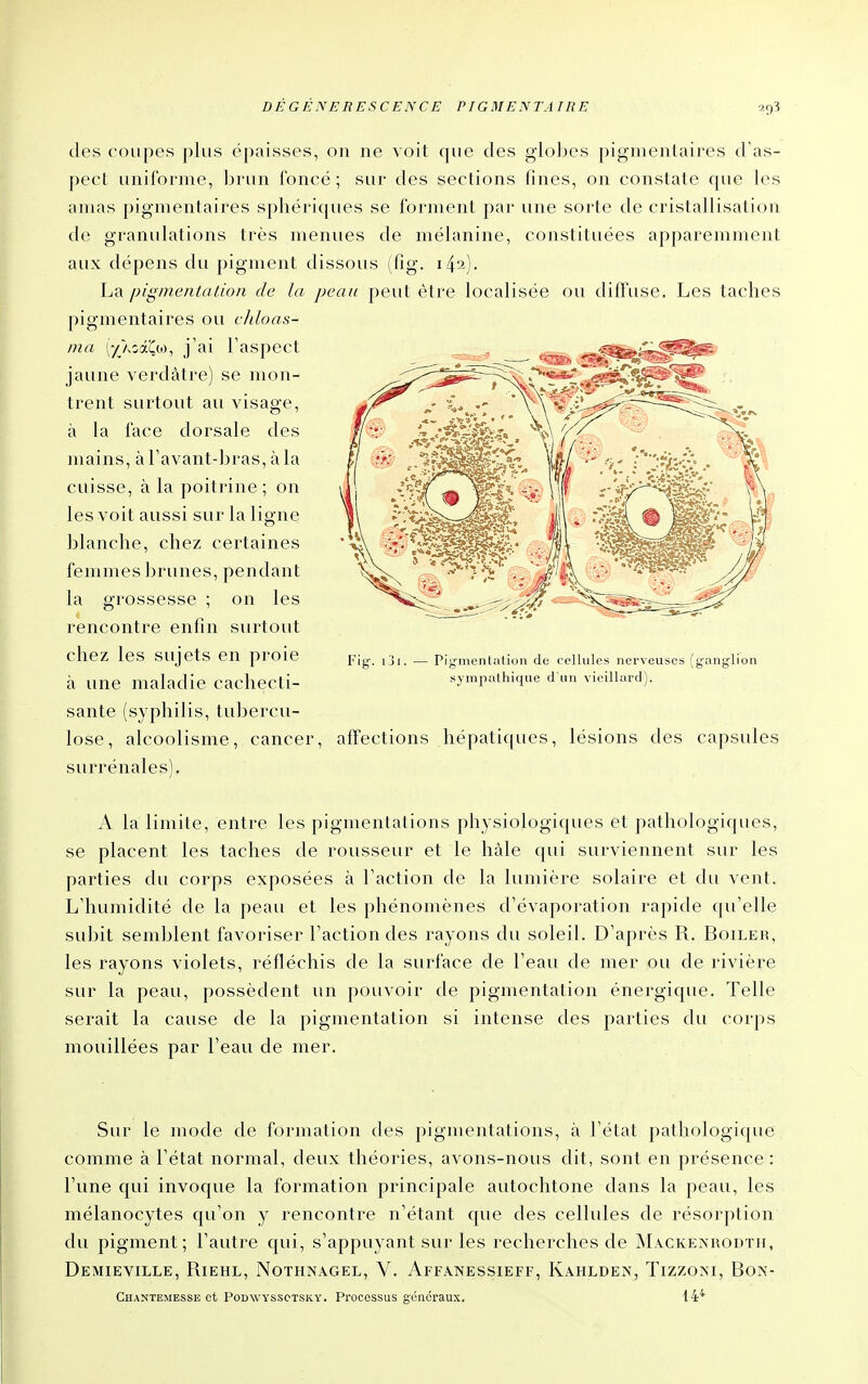 des coupes plus épaisses, on ne voit que des globes pigmentaires d'as- pect uniforme, brun foncé; sur des sections fines, on constate que les amas pigmentaires sphériques se forment par une sorte de cristallisation de granulations très menues de mélanine, constituées apparemment aux dépens du j)ignient dissous (fig. 142). La pigmentation de la peau peut être localisée ou diffuse. Les taches pigmentaires ou c/doas- ma (-/Aoâi^to, j'ai l'aspect jaune verdàtre) se mon- trent surtout au visage, à la face dorsale des mains, à l'avant-bras, à la cuisse, à la poitrine; on les voit aussi sur la ligne blanche, chez certaines femmes brunes, pendant la grossesse ; on les rencontre enfin surtout chez les sujets en proie à une maladie cachecti- sante (syphilis, tubercu- lose, alcoolisme, cancer, affections hépatiques, lésions des capsules surrénales). Fig. iji. — Pigmentation de cellules nerveuses (ganglion sympathique d'un vieillard). A la limite, entre les pigmentations physiologiques et pathologiques, se placent les taches de rousseur et le hàle qui surviennent sur les parties du corps exposées à l'action de la lumière solaire et du vent. L'humidité de la peau et les phénomènes d'évaporation rapide qu'elle subit semblent favoriser l'action des rayons du soleil. D'après R. Boiler, les rayons violets, réfléchis de la surface de l'eau de mer ou de rivière sur la peau, possèdent un pouvoir de pigmentation énergique. Telle serait la cause de la pigmentation si intense des parties du corps mouillées par l'eau de mer. Sur le mode de formation des pigmentations, à l'état pathologique comme à l'état normal, deux théories, avons-nous dit, sont en présence : l'une qui invoque la formation principale autochtone dans la peau, les mélanocytes qu'on y rencontre n'étant que des cellules de résorption du pigment; l'autre qui, s'appuyant sur les recherches de j\L\CKEXR0DTn, Demieville, Riehl, Nothnagel, V. Affanessieff, Kahldex, Tizzoni, Bon-