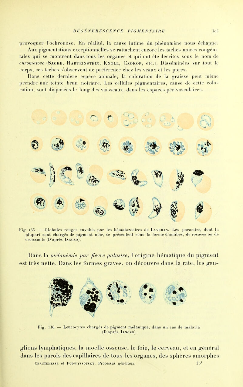 provoquer l'ochronose. lin réalité, la cause intime du phénomène nous échappe. Aux pigmentations exceptionnelles se rattachent encore les taches noires congéni- tales qui se montrent dans tous les organes et qui ont été décrites sous le nom de rhromatose (Sackiî, Hahtkinsteix, Knoll, GzOKOii, etc.). Disséminées sur tout le corps, ces taches s'observent de préférence chez les veaux et les porcs. Dans cette dernière espèce animale, la coloration do la graisse peul même prendre une teinte brun noirâtre. Les cellules pigmentaires, cause de cette colo- ration, sont disposées le long des vaisseaux, dans les espaces périvasculaires. Fig. lî). — Globules rouges envahis par les liémalozoaires de Laverax. Les parasites, dont la plupart sont chargés de pigment noir, se présentent sous la Cornie d'amibes, de rosaces ou de croissants (D'après Ianczo). Dans la inèlanèmie par fièvre palustre^ Torigine hématiqiie du pigment est très nette. Dans les formes graves, on découvre dans la rate, les gan- Fig. i3f). — Leucocytes chargés de pigment mélanique, dans un eus de malaria (D'après Ianczo). glions lymphatiques, la moelle osseuse, le Ibie, le cerveau, et en général dans les parois des capillaires de tous les organes, des sphères amorphes Chaktemesse et Podwyssotsky. Processus généraux. 15'