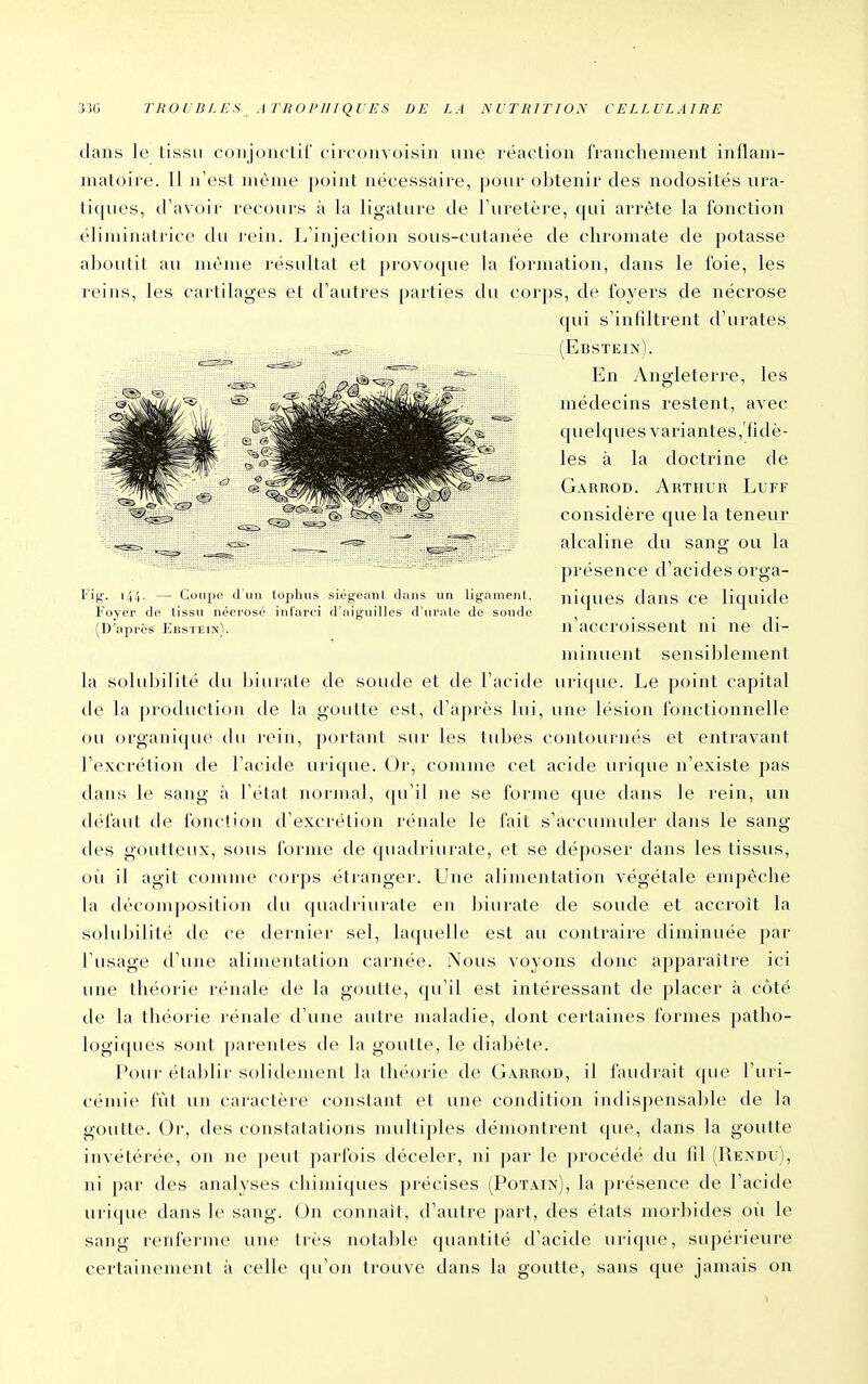 dans le tissu conjonctif circoiivoisin une réaction franchement inflam- matoire. Il n'est même point nécessaire, pour obtenir des nodosités ura- tiques, d'avoir recours à la ligature de l'uretère, qui arrête la fonction éliminatrice du rein. L'injection sous-cutanée de chromate de potasse al^outit au même résultat et provoque la formation, dans le foie, les reijis, les cartilages et d'autres j)arties du corps, de foyers de nécrose qui s'infiltrent d'urates (Ebstein). En Angleterre, les médecins restent, avec quelques variantes,fidè- les à la doctrine de Garrod. Arthur Luff considère que la teneur alcaline du sang ou la ju'ésence d'acides orga- niques dans ce liquide n'accroissent ni ne di- minuent sensildement la solubilité du ))iurate de soude et de l'acitle urique. Le point capital tle la production de la goutte est, d'après lui, une lésion fonctionnelle ou organi(|uo du rein, portant sur les tubes contournés et entravant l'excrétion de l'acide urique. Or, comme cet acide urique n'existe pas dans le sang à l'état normal, qu'il ne se forme que dans le rein, un défaut de fonction d'excrétion rénale le fait s'accunuiler daus le sang des goutteux, sous forme de (piadriurate, et se déposer dans les tissus, où il agit comme corps étranger. Une alimentation végétale empêche \',\ cb'composition du quadriurate en biurate de soude et accroît la soluljilité de ce dernier sel, laquelle est au contraire diminuée par l'usage d'une alimentation carnée. Nous voyons donc apparaître ici une théorie rénale de la goutte, qu'il est intéressant de placer à côté de la théorie rénale d'une autre maladie, dont certaines formes patho- logiques sont parentes de la goutte, le diabète. Pour éta])b'r solidement la théorie de Garrod, il faudrait que l'uri- cémie fût un caractère constant cl une condition iiulispensalile de la goutte. Or, des constatations nudtiples démontrent que, dans la goutte invétérée, on ne j)eul pai-fois déceler, ni par le procédé du fil (Rendu), ni par des analyses cliimiques précises (Potain), la ])résence de l'acide urique dans le sang. On connaît, d'autre part, des états nioi'l)i(les oii le sang renferme une très notable (juantité d'acide uri(|ue, supérieure certainement à celle qu'on trouve dans la goutte, sans ([ue jamais on
