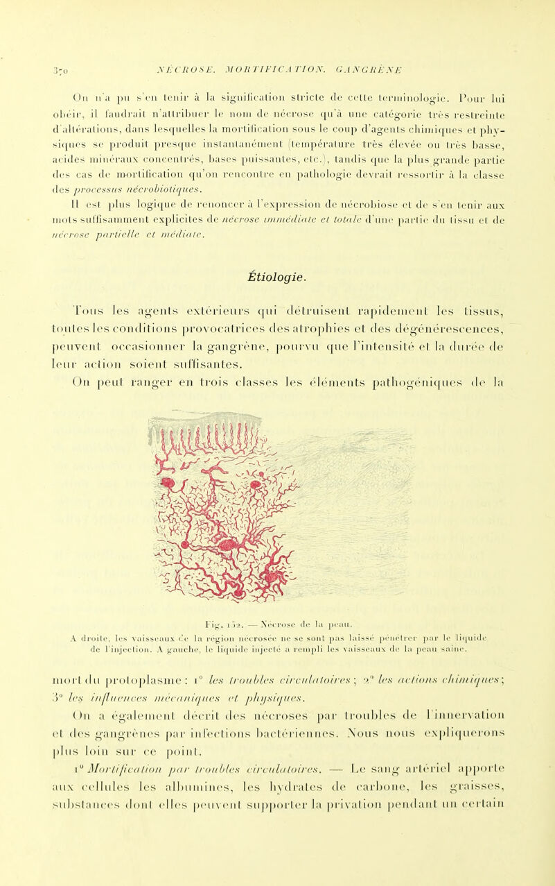 SÉCJIOSE. MOHJ/FICA TJO.\. G .t .\ G JIK .\ 0\t u n p\i s cil Iriiir à la siiiiiilicaliou siriclc de celle Icnniiiologie. Polh- lui ol)cii'. il laudiail n alli'iljiicr le unui de nécrose (|u à une culégorie très reslreiule d alli'iMlions, dans les(juelles la niorlilicalion sous le coup d'ageuls chimiques el pliy- si([ues se prodilil pres((iie iiislanian('iiicnI Ieui|)(''ralure très élevée ou Irès basse, acides iiiiiK'raux concenirés, l)ases puissanlcs, elc.;, tandis que la plus grande partie ties cas de niorlilicalion cpi'on renconlre en pathologie devrail ressorlir à la classe (les j)rocessiis nécrohioliques. 11 est plus Iogi([U(^ de renoncera l'expression de nécrohiose cl de s'en leiiir aux niols saHîsaninient expliciles de nccrose iiiiiiiédiulc el loUilr d une parlie du (issu el de iiccra^c parlicllc et iiicduili'. Étiologie. Tons les ai^'oiils cxlrrieuis (nii (lélriiisciil rapidciiiciil 1rs lissas, toutes les coiulilions provocalriccs ties atrophies et des dég-énérescences, [)eiivciil occasioiiiicr la gaiigrèite, poiirvii ([iie l'intensité et la diii'('M' de leur aclioii soient siiriisantes. On ()Ctil ranger en trois classes les ([('inents patliogeni(|ucs de la l'ij,'. i.V^.. —Ni''iT(iS(' (le lu peau. A dl-nlli', les vaissi'aiix la ri'g-iijii ikm-I'usim- iif se son! [)as lai-.-c ]iriii'l i rr par le ll(|iii(k' (le riiijc'cliuri. A i^aiichr, li' lii|iiiilc' injrcli; a ri'iii|)li les \aissL'aii\ (le la peau >aiiic. molidn proloplasiiie : i (es Innihlcs rii-ctildloircs \ ■> les nc/iti/is c/i////kjiics ; ,') les nijhiciiccs jiiccdiiujii<>s cl ifSKjacs. ( )n a rgalciiicnl drcril des ni'croses pai- lioiililcs de rinnci x alion cl d<'s gaiiorciics pa r i n l'cct ions bactériennes. .\(jus nous e.xpl i(Hicrons plus loin sur ce poinl. Mni lijivdlioit pur Iroitbics circitbiloirt-s. — Le sang artériel a|)|)oi-l(> aux cellules les a 11 )ii ni i nés, les livdrales de carhonc, les graisses, substances doni elles peuNcnl supporter la |)i i\alion pendant un certain i