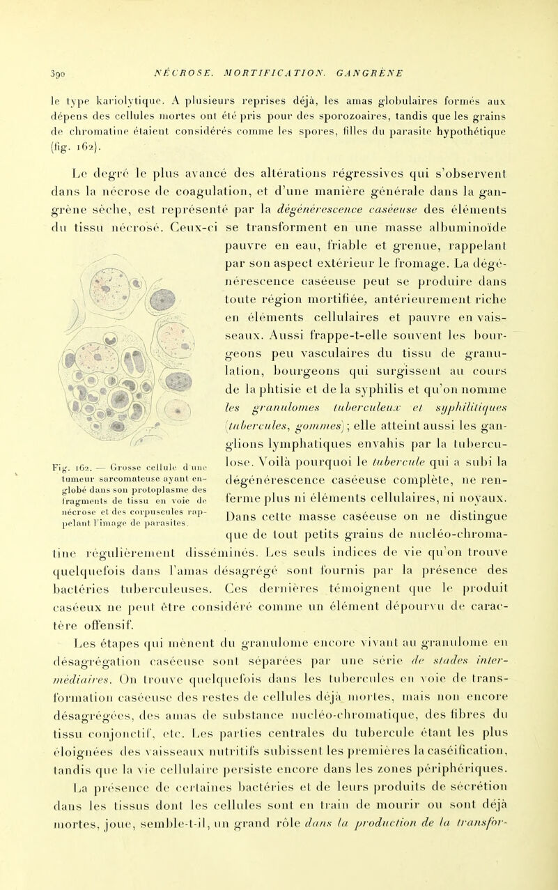 le type kariolytiquc. A jDliisieurs l'eprises déjà, les amas globulaires foi'més aux dépens des cellules iiiortes ont été pris pour des sporozoaires, tandis que les grains de chromatine étaient considérés comme les spores, iilles du parasite hypothétique (fig. ,62). Le degré le plus avancé des altérations régressives qui s'observent dans la nécrose de coagulation, et d'une manière générale dans la gan- grène sèche, est représenté par la dégénérescence caséeuse des éléments du tissu nécrosé. Ceux-ci se transforment en une masse albuminoïde pauvre en eau, Iriable et grenue, rappelant par son aspect extérieur le l'romage. La tlégé- nérescence caséeuse peut se produire dans toute région mortifiée, antérieurement riche en éléments cellulaires et pauvre en vais- seaux. Aussi frappe-t-elle souvent les l)our- geons peu vasculaires du tissu de granu- lation, bourgeons qui surgissent au cours de la phtisie et de la syphilis et qu'on nomme les granulomes luherciileu.v el si/jj/u'li/iques [///hercules, goninies); elle atteint aussi les gan- glions lymphatiques envahis par la tubercu- lose. ^'^oilà pourquoi le t/iberc//le qui a subi la dégénérescence caséeuse complète, ne ren- ferme plus ni éléments cellulaires, ni noyaux. Dans cette masse caséeuse on ne distingue que de tout petits grains de nucléo-chroma- tine régulièreuicnt disséminés. Les seuls indices de vie qu'on trouve quelquefois dans l'amas désagrégé sont fournis ])ar la présence des bactéries tuberculeuses. Ces dernières témoignent que le produit caséeux ne peut être considéré comme un élément dépourx u de carac- tère offensif. Les étapes (pii mèju'iit du granubjme eiuore ^ i\ aiil au granulome eu désagrégation caséeuse sont séparées \r<\v une série de stades inler- Dièdiaires. On Irom e (|U(>l(|ui'(ois dans les tul)ei'cul(^s (mi \oie de trans- formation caséeuse des restes de cellules déjà nioi-les, nutis non encore désagrégées, des amas de substaïu^e nucléo-chromatique, des libres du tissu conjonctiC, (>lc. Les parties centrales du tubercule étant les plus éloignées des \ aisseau\ nulrilifs subissent les premières la caséification, tandis que la \ ie cellulaire persiste encore dans les zones périphériques. La présence de certaines bactéries et de leurs produits de sécrétion dans les tissus dont les cellules sont en train de mourir ou sont déjà )nortes, joue, semble-t-il, un grand rôle dans la prodi/ction de la iransfor- Fig. iC'2. — Grosse cellule d une tumeui- sarcomateuse ayant en- globé dans son protoplasme des fragments de tissu en voie de nécrose et des corpuscules rap- pelant l'image de parasites.