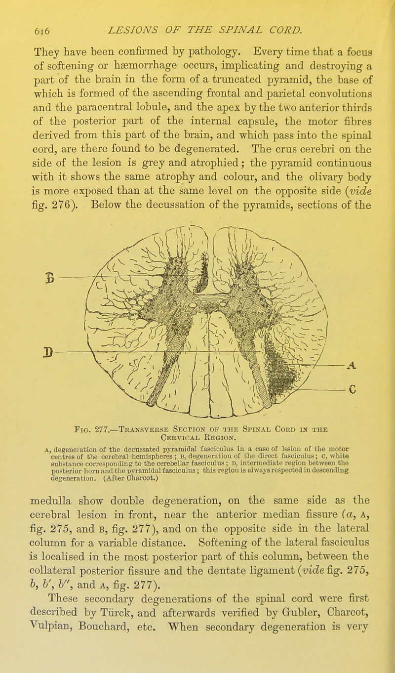 They have been confii-med by pathology. Every time that a focus of softening or haemorrhage occurs, implicating and destroying a part of the brain in the form of a truncated pyramid, the base of which is formed of the ascending frontal and parietal convolutions and the paracentral lobule, and the apex by the two anterior thirds of the posterior part of the internal capsule, the motor fibres derived from this part of the brain, and which pass into the spinal cord, are there found to be degenerated. The crus cerebri on the side of the lesion is grey and atrophied; the pyramid continuous with it shows the same atrophy and colour, and the olivary body is more exposed than at the same level on the opposite side (vide fig. 276). Below the decussation of the pyramids, sections of the Fig. 277.—Tkansversb Section of the Spinal, Cord in the Cervical Region. A, degeneration of the decussated pyramidal fasciculus in a case of lesion of the motor centres of the cerebral hemispheres ; B, degeneration of the direct fasciculus; c, white substance corresponding to the cerebellar fasciculus; D, intermediate region between the posterior honi and the pyramidal fasciculus; this region is always respected in descending degeneration. (After Charcot.) medulla show double degeneration, on the same side as the cerebral lesion in front, near the anterior median fissure (a, A, fig. 275, and B, fig. 277), and on the opposite side in the lateral column for a variable distance. Softening of the lateral fasciculus is localised in the most posterior part of this column, between the collateral posterior fissure and the dentate ligament (-yicZe fig. 275, h, h', h, and A, fig. 277). These secondary degenerations of the spinal cord were first described by Tiirck, and afterwards verified by Grubler, Charcot, Vulpian, Bouchard, etc. When secondary degeneration is very