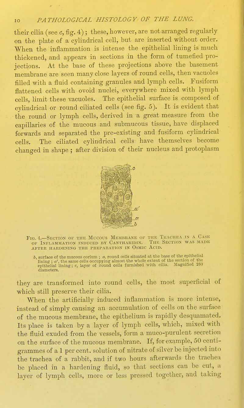 their cilia (see c, fig. 4) ; these, however, are not arranged regularly on the plate of a cylindrical cell, but are inserted without order. When the inflammation is intense the epithelial lining is much thickened, and appears in sections in the form of tumefied pro- jections. At the base of these projections above the basement membrane are seen many close layers of round cells, then vacuoles filled with a fluid containing granules and lymph cells. Fusiform flattened cells with ovoid nuclei, everywhere mixed with lymph cells, limit these vacuoles. The epithelial surface is composed of cylindrical or round ciliated cells (see fig. 5). It is evident that the round or lymph cells, derived in a great measure from the capillaries of the mucous and submucous tissue, have displaced forwards and separated the pre-existing and fusiform cylindrical cells. The ciliated cylindrical cells have themselves become changed in shape ; after division of their nucleus and protoplasm Fig. 4.—Section of the Mucous Membrane of the Trachea in a Case of Inflammation induced by Cantharidin. The Section was made after hardening the preparation in Osmic Acid. 6, surface of the mucous corium ; a, round cells situated at the base of tlie epithelial lining ; a', the same cells occupying almost the whole extent of the section of the epithelial lining; c, layer of round cells furnished with cilia. MagniSed 250 diameters. they are transformed into round cells, the most superficial of which still preserve their cilia. When the artificially induced inflammation is more intense, instead of simply causing an accumulation of cells on the surface of the mucous membrane, the epithelium is rapidly desquamated. Its place is taken by a layer of lymph cells, which, mixed with the fluid exuded from the vessels, form a muco-purulent secretion on the surface of the mucous membrane. If, for example, 50 centi- grammes of a 1 per cent, solution of nitrate of silver be injected into the trachea of a rabbit, and if two hours afterwards the trachea be placed in a hardening fluid, so that sections can be cut, a layer of lymph cells, more or less pressed together, ami taking