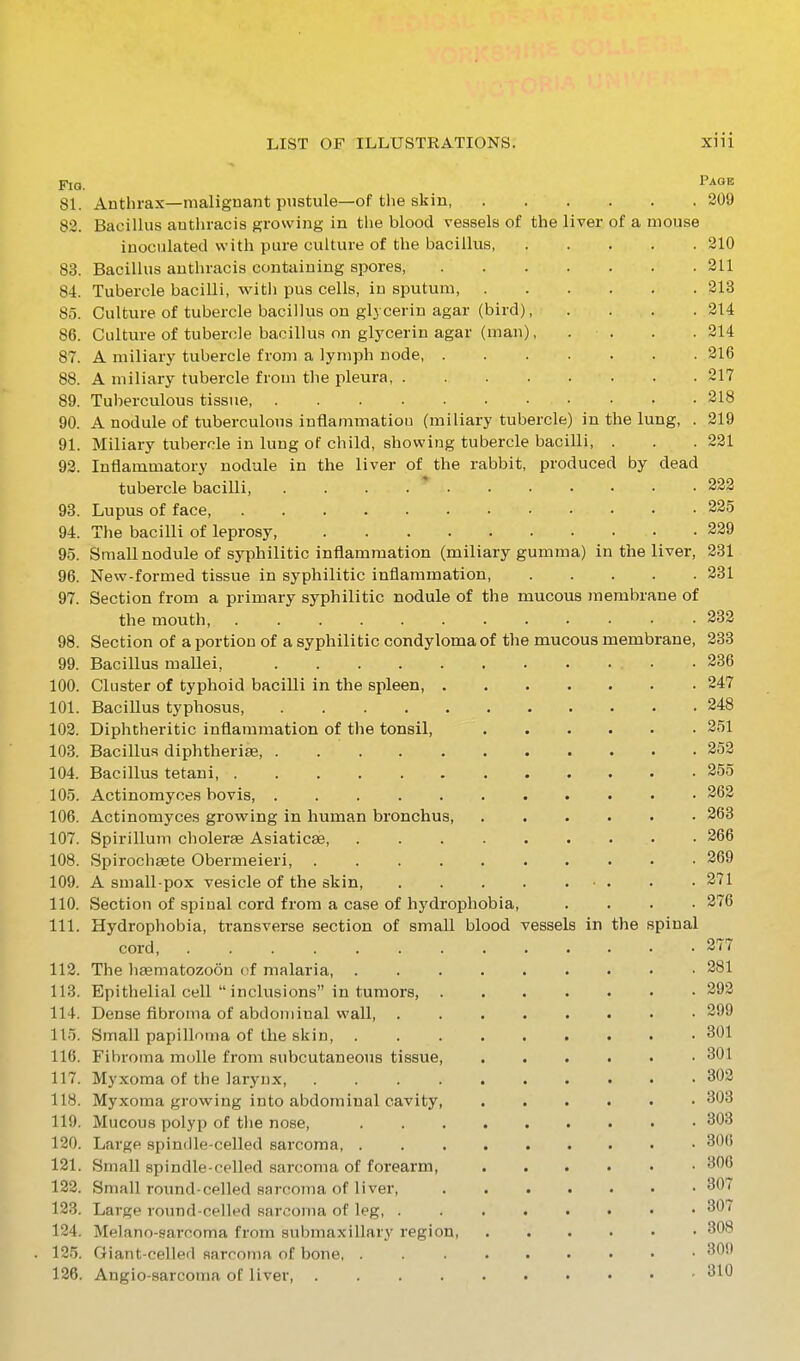 Fig. ^^'^^ 81. Anthrax—malignant pustule—of the skin, . . . . . . 209 82. Bacillus authracis growing in the blood vessels of the liver of a mouse inoculated with pure culture of the bacillus 210 83. Bacillus authracis containing spores, 211 84. Tubercle bacilli, with pus cells, in sputum 213 85. Culture of tubercle bacillus on glycerin agar (bird), . . . .314 86. Culture of tubercle bacillus on glj'cerin agar (man), . . . .214 87. A miliary tubercle fronj a lymph node 216 88. A miliary tubercle from the pleura, 217 89. Tuberculous tissue, 218 90. A nodule of tuberculous inflammatiou (miliary tubercle) in the lung, . 219 91. Miliary tubercle in lung of child, showing tubercle baciUi, . . .221 92. Inflammatory nodule in the liver of the rabbit, produced by dead tubercle bacilli 222 93. Lupus of face, 225 94. The bacilli of leprosy, 229 95. Small nodule of syphilitic inflammation (miliary gumma) in the liver, 231 96. New-formed tissue in syphilitic inflammation 231 97. Section from a primary syphilitic nodule of the mucous membrane of the mouth, . 232 98. Section of a portion of a syphilitic condyloma of the mucous membrane, 233 99. Bacillus mallei, • -236 100. Cluster of typhoid bacilli in the spleen, 247 101. Bacillus typhosus, 248 102. Diphtheritic inflammation of the tonsil, 251 103. Bacillus diphtherise, . 252 104. Bacillus tetani, 255 105. Actinomyces bovis, 262 106. Actinomyces grovs^ing in human bronchus 263 107. Spirillum cholerae Asiaticae, • 266 108. Spirochsete Obermeieri, 269 109. A small-pox vesicle of the skin, 271 110. Section of spinal cord from a case of hydrophobia, .... 276 111. Hydrophobia, transverse section of small blood vessels in the spinal cord, 277 112. The ligematozoon of malaria, 281 113. Epithelial cell inclusions in tumors, 292 114. Dense fibroma of abdominal wall, • 299 115. Small papilloma of the skin, • 801 116. Fibroma molle from subcutaneous tissue 301 117. Myxoma of the larynx, 302 118. Myxoma growing into abdominal cavity, 303 119. Mucous polyp of the nose, 303 120. Large spindle-celled sarcoma 306 121. Small spindle-celled sarcoma of forearm, 306 122. Small round-celled sarcoma of liver, 307 123. Large round-celled sarcoma of leg, 307 124. Melano-sarcoma from submaxillary region • • 308 . 125. Giant-celled sarcoma of bone, 309 126. Angio-sarcoma of liver 310