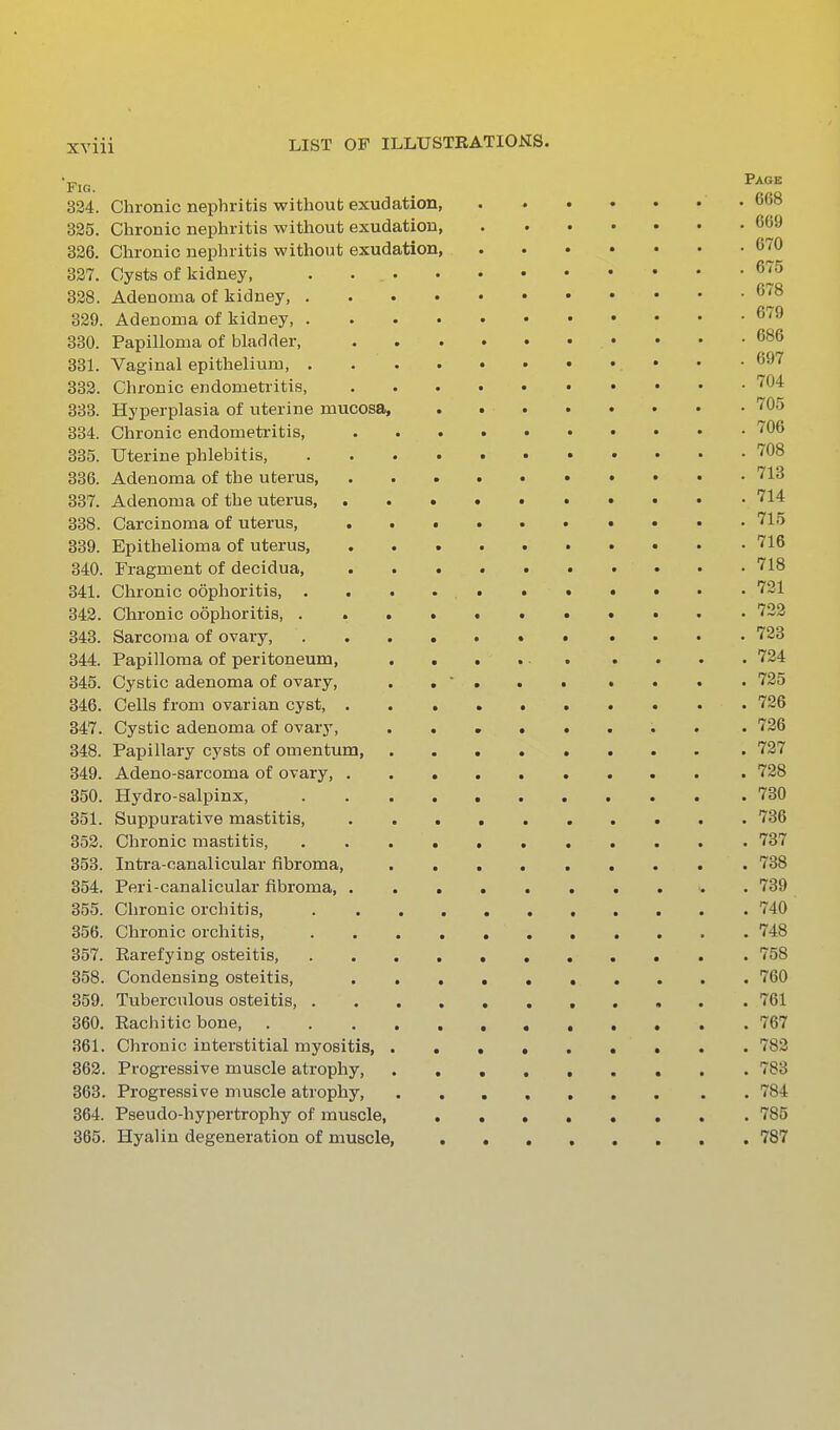 334. Chronic nephritis without exudation, • . 668 325. Chronic nephritis without exudation 669 336. Chronic nephritis without exudation, 670 337. Cysts of kidney, . . 675 328. Adenoma of kidney, 678 329. Adenoma of kidney, 679 330. Papilloma of bladder • • • -686 331. Vaginal epithelium, • • • 697 333. Chronic endometritis, ''O'l 333. Hyperplasia of uterine mucosa, . ''OS 334. Chronic endometritis, ^06 335. Uterine phlebitis, '^'08 336. Adenoma of the uterus 713 337. Adenoma of the uterus '''14 338. Carcinoma of uterus, ^^^ 339. Epithelioma of uterus, '5'16 340. Fragment of decidua '''18 341. Chronic oophoritis, '''21 342. Chronic oophoritis, ...•..••>.• ''22 343. Sarcoma of ovary, . .... 723 344. Papilloma of peritoneum, '724 345. Cystic adenoma of ovary, .... 725 346. Cells from ovarian cyst, 736 347. Cystic adenoma of ovary, ........ . 726 348. Papillary cysts of omentum, 727 349. Adeno-sarcoma of ovary, 728 350. Hydro-salpinx, 730 351. Suppurative mastitis, 736 353. Chronic mastitis, 737 353. Intra-canalicular fibroma, 738 354. Peri-canalicular fibroma, . 739 355. Chronic orchitis, 740 356. Chronic orchitis, 748 357. Rarefying osteitis 758 358. Condensing osteitis, 760 359. Tuberculous osteitis, 761 360. Rachitic bone 767 361. Chronic interstitial myositis, 783 362. Progressive muscle atrophy, ......... 783 363. Progressive muscle atrophy, 784 364. Pseudo-hypertrophy of muscle, 785 365. Hyalin degeneration of muscle, ........ 787
