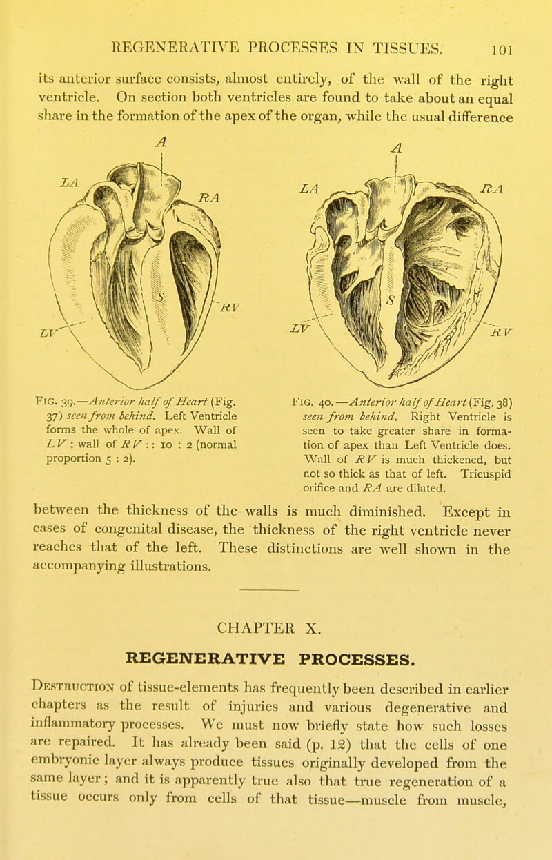 its anterior surface consists^ almost entirely, of the wall of the right ventricle. On section both ventricles are found to take about an equal share in the formation of the apex of the organ, while the usual difference A Fig. 39.—Anterior half of Heart (Fig. 37) seen from behind. Left Ventricle forms the whole of apex. Wall of L V : wall of J?y :: 10 : 2 (normal proportion 5 : 2). A I Fig. 40. —Anterior half of Heart (Fig. 38) seen from behind. Right Ventricle is seen to take greater share in forma- tion of apex than Left Ventricle does. Wall of RV xi, much thickened, but not so thick as that of left. Tricuspid orifice and RA are dilated. between the thickness of the walls is much diminished. Except in cases of congenital disease, the thickness of the right ventricle never reaches that of the left. These distinctions are well shown in the accompanying illustrations. CHAPTER X. REGENERATIVE PROCESSES. Destruction of tissue-elements has frequently been described in earher chapters as the result of injuries and various degenerative and inflammatory processes. We must now briefly state how such losses are repaired. It has already been said (p. 12) that the cells of one embryonic layer always produce tissues originally developed from the same layer; and it is apparently true also that true regeneration of a tissue occurs only from cells of that tissue—muscle from muscle.