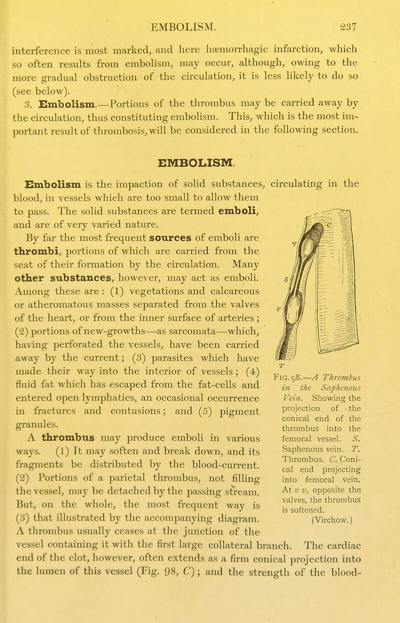 interference is most marked^ and here haeniorrhagic infarction, which so often results from embolism, may occur, although, owing to the more gradual obstruction of the circulation, it is less Ukely to do so (see below). 3. Embolism.—Portions of the thrombus may be carried away by the circulation, thus constituting embolism. This, which is the most im- portant result of thrombosis, will be considered in the following section. EMBOLISM. Embolism is the impaction of solid substances, circulating in the blood, in vessels which are too small to allow them to pass. The solid substances are termed emboli, and are of veiy varied nature. By far the most frequent sources of emboli are thrombi, portions of which are carried from the seat of their formation by the circulation. Many other substances, however, may act as emboli. Among these are : (1) vegetations and calcareous or atheromatous masses separated from the valves of the heart, or from the inner surface of arteries ; (2) portions of new-growths—as sarcomata—which, having perforated the vessels, have been carried away by the current; (3) parasites which have made their way into the interior of vessels; (4) fluid fat which has escaped from the fat-cells and entered open lymphatics, an occasional occurrence in fractures and contusions; and (5) pigment granules. A thrombus may produce emboli in various ways. (1) It may soften and break down, and its fragments be distributed by the blood-current. (2) Portions of a parietal thrombus, not filling the vessel, may be detached by the passing sti-eam. But, on the whole, the most frequent way is (3) that illustrated by the accompanying diagram. A thrombus usually ceases at the junction of the vessel containing it with the first large collateral branch. The cardiac end of the clot, however, often extends as a firm conical projection into the lumen of this vessel (Fig. 98, C); and the strength of the blood- FiG. 98.—A Tlwombus ill the Saphenous Vein. Showing the projection of the conical end of the thrombus into the femoral vessel. S. Saphenous vein. T. Thrombus. C. Coni- cal end projecting into femoral vein. At V v., opposite the valves, the thrombus is softened. (Virchow.)