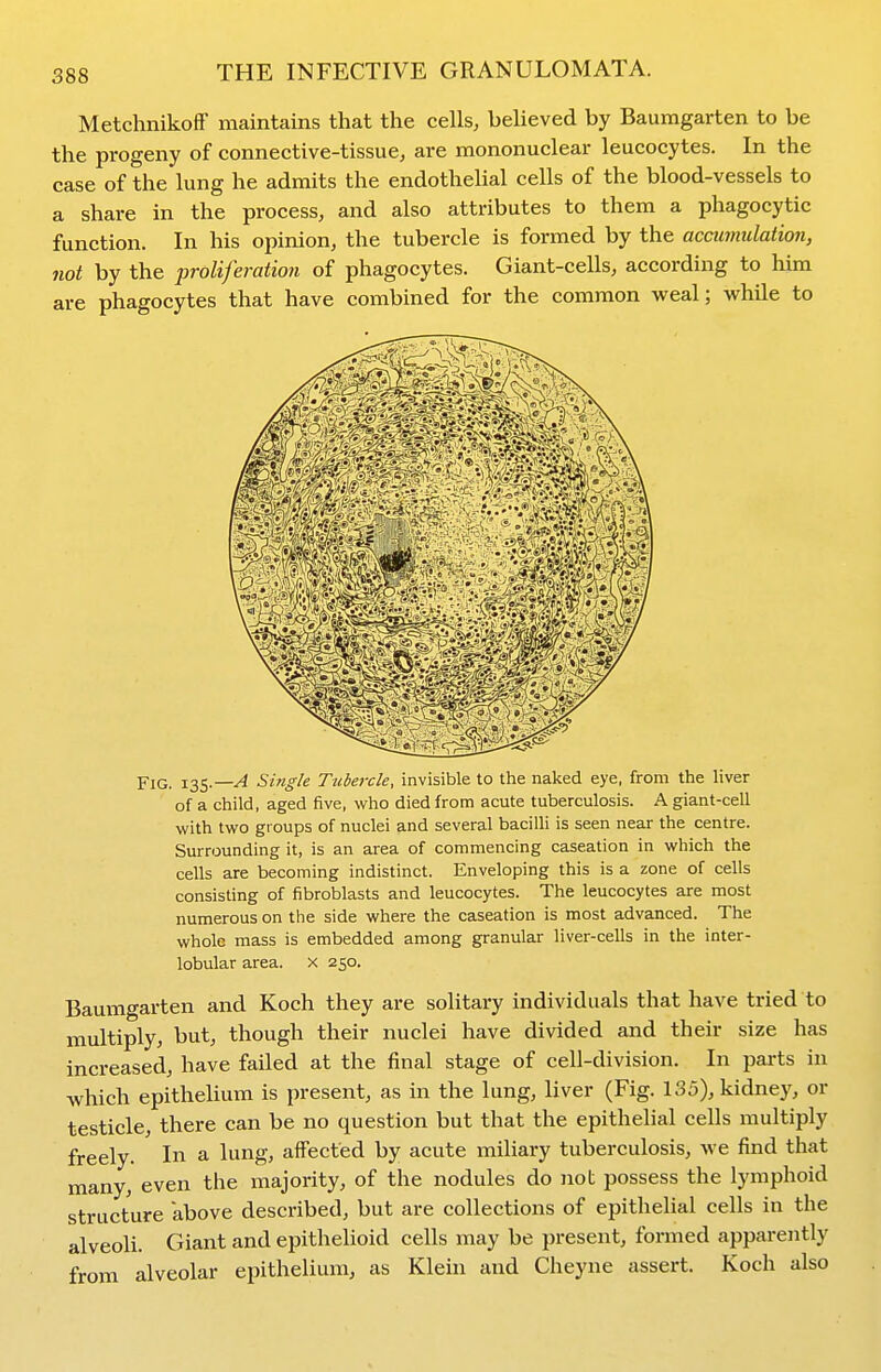 Metchnikoff maintains that the cells, believed by Baumgarten to be the progeny of connective-tissue, are mononuclear leucocytes. In the case of the lung he admits the endothelial cells of the blood-vessels to a share in the process, and also attributes to them a phagocytic function. In his opinion, the tubercle is formed by the accumulation, not by the proliferation of phagocytes. Giant-cells, according to him are phagocytes that have combined for the common weal; while to piQ 135.—^ Single Tubercle, invisible to the naked eye, from the liver of a child, aged five, who died from acute tuberculosis. A giant-cell with two groups of nuclei and several bacilli is seen near the centre. Surrounding it, is an area of commencing caseation in which the cells are becoming indistinct. Enveloping this is a zone of cells consisting of fibroblasts and leucocytes. The leucocytes are most numerous on the side where the caseation is most advanced. The whole mass is embedded among granular liver-cells in the inter- lobular area, x 250. Baumgarten and Koch they are solitary individuals that have tried to multiply, but, though their nuclei have divided and their size has increased, have failed at the final stage of cell-division. In parts in which epithelium is present, as in the lung, liver (Fig. 135), kidney, or testicle, there can be no question but that the epithelial cells multiply freely. In a lung, affected by acute miliary tuberculosis, we find that many, even the majority, of the nodules do not possess the lymphoid structure above described, but are collections of epithelial cells in the alveoli. Giant and epithelioid cells may be present, formed apparently from alveolar epithelium, as Klein and Cheyne assert. Koch also