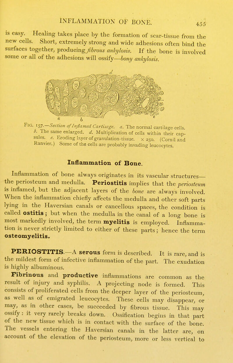 is easy. Hccaling takes place by the formation of scar-tissue from the new cells. Short, extremely strong and wide adhesions often bind the surfaces together, producing/6roK* aviajlosis. If the bone is involved some or all of the adhesions will ossify—iow?/ ankylosis. Fig. IS7.—Section of Inflamed Cartilage, a. The normal cartilage cells. b. The same enlarged, d. Multiplication of cells within their cap- sules. ^. Eroding layer of granulation-tissue, x 250. (Cornil and Ranvier.) Some of the cells are probably invading leucocytes. Inflammation of Bone. Inflammation of bone always originates in its vascular structures the periosteum and medulla. Periostitis implies that the periosteim is inflamed, but the adjacent layers of the bone are always involved. When the inflammation chiefly affects the medulla and other soft parts lying in the Haversian canals or cancellous spaces, the condition is called ostitis; but when the medulla in the canal of a long bone is most markedly involved, the term myelitis is employed. Inflamma- tion is never strictly Umited to either of these parts; hence the term osteomyelitis. PERIOSTITIS.—A serous form is described. It is rare, and is the mildest form of infective inflammation of the part. The exudation is highly albuminous. Fibrinous and productive inflammations are common as the result of injury and syphilis. A projecting node is formed. This consists of proliferated cells from the deeper layer of the periosteum, as well as of emigrated leucocytes. These cells may disappear, or may, as in other cases, be succeeded by fibrous tissue. This may ossify : it very rarely breaks down. Ossification begins in that part of the new tissue which is in contact with the surface of the bone. The vessels entering the Haversian canals in the latter are, on account of the elevation of the periosteum, more or less vertical to