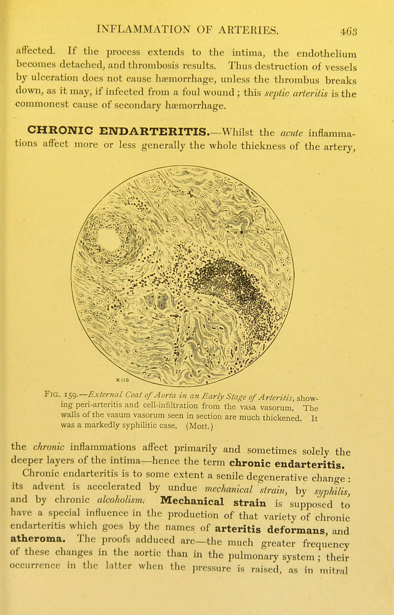 afFected. If the process extends to the intima, the endothehum becomes detached, and thrombosis results. Thus destruction of vessels by ulceration does not cause hsemorrhage, unless the thrombus breaks down, as it may, if infected from a foul wound; this septic arteritis is the commonest cause of secondary hfemorrhage. CHRONIC ENDARTERITIS Whilst the acute inflamma- tions affect more or less generally the whole thickness of the artery. Fig. External Coat of Aorta in an Early Stage of Arteritis, show- ing peri-arteritis and cell-infiltration from the vasa vasorum. The walls of the vasum vasorum seen in section are much thickened. It was a markedly syphilitic case. (Mott.) the chronic inflammations affect primarily and sometimes solely the deeper layers of the intima—hence the term chronic endarteritis. Chronic endarteritis is to some extent a senile degenerative change • its advent is accelerated by undue mechanical strain, by syjMlis, and by chronic alcoholism. Mechanical strain is supposed to' have a special influence in the production of that variety of chronic endarteritis which goes by the names of arteritis deformans, and atheroma. The proofs adduced are—the much greater frequency of these changes in the aortic than in the pulmonary system ; their occurrence in the latter when the pressure is raised, as in mitral