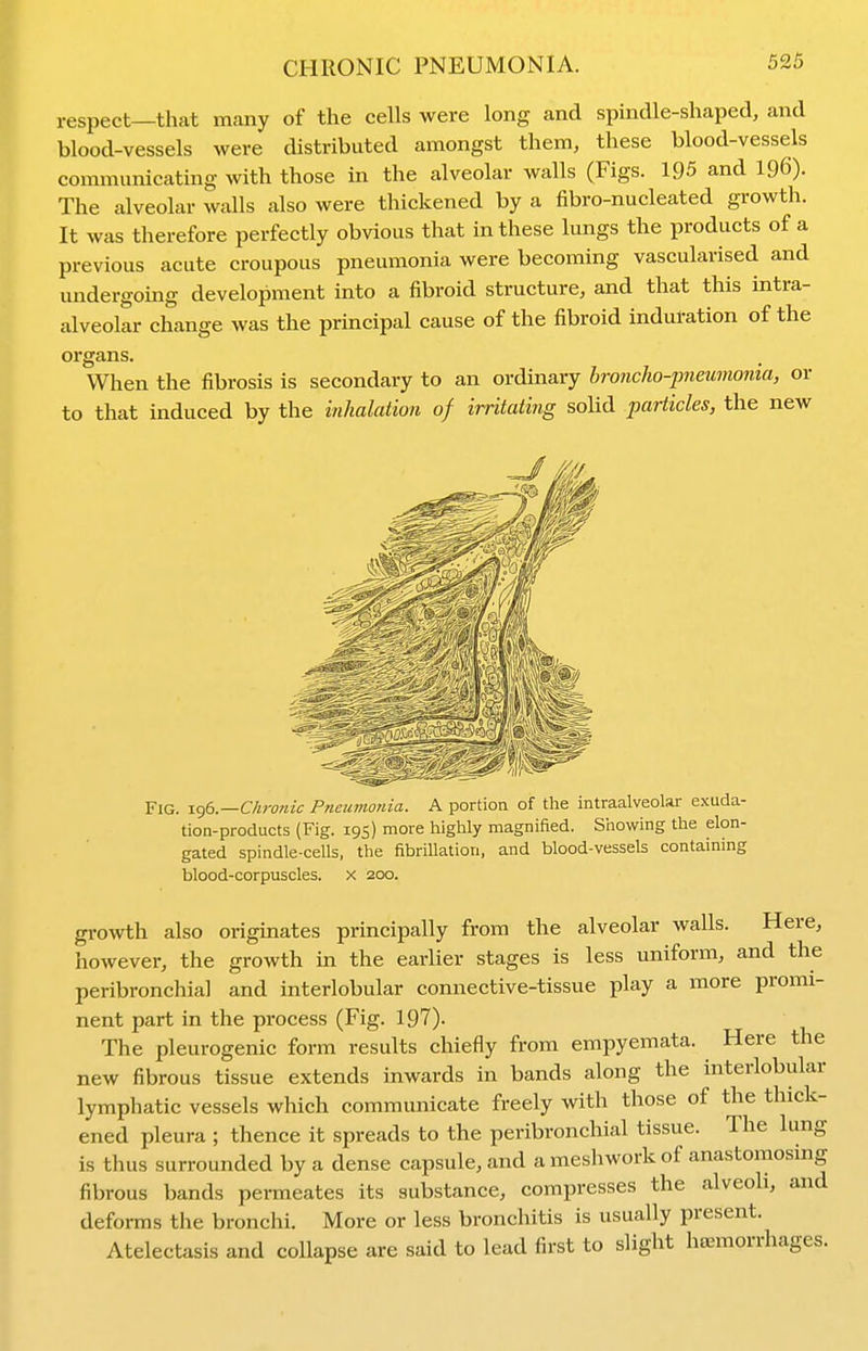 respect—that many of the cells were long and spindle-shaped, and blood-vessels were distributed amongst them, these blood-vessels communicating with those in the alveolar walls (Figs. 195 and 196). The alveolar walls also were thickened by a fibro-nucleated growth. It was therefore perfectly obvious that in these lungs the products of a previous acute croupous pneumonia were becoming vascularised and undergoing development into a fibroid structure, and that this intra- alveolar change was the principal cause of the fibroid induration of the organs. When the fibrosis is secondary to an ordinary broncho-pnetimonia, or to that induced by the inhalation of irritating soUd particles, the new Fig. 1()6.—Chr07uc Pneumonia. A portion of the intraalveolar exuda- tion-products {Fig. 19s) more highly magnified. Showing the elon- gated spindle-cells, the fibrillation, and blood-vessels containing blood-corpuscles, x 200. growth also originates principally from the alveolar walls. Here, however, the growth in the earlier stages is less uniform, and the peribronchial and interlobular connective-tissue play a more promi- nent part in the process (Fig. 197). The pleurogenic form results chiefly from empyemata. Here the new fibrous tissue extends inwards in bands along the interlobular lymphatic vessels which communicate freely with those of the thick- ened pleura ; thence it spreads to the peribronchial tissue. The lung is thus surrounded by a dense capsule, and a meshwork of anastomosmg fibrous bands permeates its substance, compresses the alveoh, and deforms the bronchi. More or less bronchitis is usually present. Atelectasis and collapse are said to lead first to slight haemorrhages.