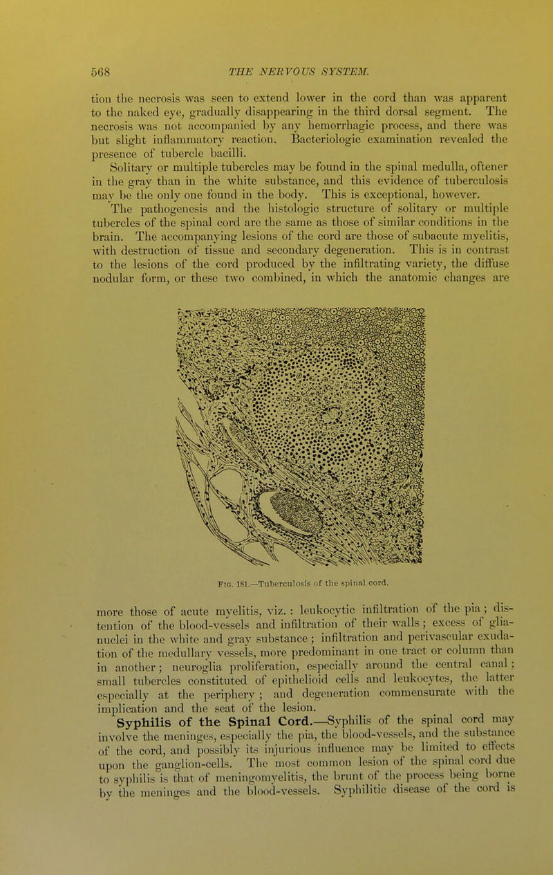 tion the necrosis was seen to extend lower in the cord than was apparent to the naked eye, gradually disappearing in the third dorsal segment. The necrosis was not accompanied by any hemorrhagic process, and there was but slight inflammatory reaction. Bacteriologic examination revealed the presence of tubercle bacilli. Solitary or multiple tubercles may be found in the spinal medulla, oftener in the gray than in the white substance, and this evidence of tuberculosis may be the only one found in the body. This is exceptional, however. The pathogenesis and the histologic structure of solitary or multiple tubercles of the spinal cord are the same as those of similar conditions in the brain. The accompanying lesions of the cord are those of subacute myelitis, with destruction of tissue and secondary degeneration. This is in contrast to the lesions of the cord produced by the infiltrating variety, the diffuse nodular form, or these two combined, in which the anatomic changes are Ftg. 181.—Tuberculosis of the spinal cord. more those of acute myelitis, viz. : leukocytic infiltration of the pia; dis- tention of the blood-vessels and infiltration of their walls; excess of glia- nuclei in the white and gray substance; infiltration and perivascular exuda- tion of the medullary vessels, more predominant in one tract or colunm than in another; neuroglia proliferation, especially around the central canal; small tubercles constituted of epithelioid cells and leukocytes, the latter especially at the periphery ; and degeneration commensurate with the implication and the seat of the lesion. Syphilis of the Spinal Cord.—Syphilis of the spinal cord may involve the meninges, especially the pia, the blood-vessels, and the substance of the cord, and possibly its injurious influence may be limited to effects upon the ganglion-cells. The most common lesion of the spinal cord due to syphilis is that of meningomyelitis, the brunt of the process being borne by the meninges and the blood-vessels. Syphilitic disease of the cord is