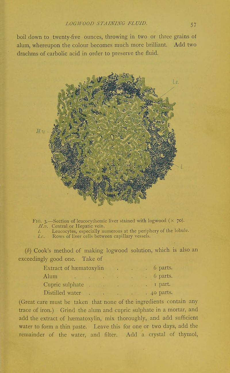 LOGWOOD STAINING FLUID. boil down to twenty-five ounces, throwing in two or three grains of alum, whereupon the colour becomes much more brilliant. Add two drachms of carbolic acid in order to preserve the fluid. Fig. 3.—Section of leucocythemic liver .stained with logwood (x 70). H. v. Central or Hepatic vein. /. Leucocytes, especially numerous at the periphery of the lobule. I. e. Rows of liver cells between capillai-y vessels. {b) Cook's method of making logwood solution, which is also an exceedingly good one. Take of Extract of hsematoxylin . . .6 parts. Alum 6 parts. Cupric sulphate . . .1 part. Distilled water 40 parts. (Great care must be taken that none of the ingredients contain any trace of iron.) Grind the alum and cupric sulphate in a mortar, and add the extract of hsematoxylin, mix thoroughly, and add sufficient water to form a thin j^aste. Leave this for one or two days, add the remainder of the water, and filter. Add a crystal of thymol.