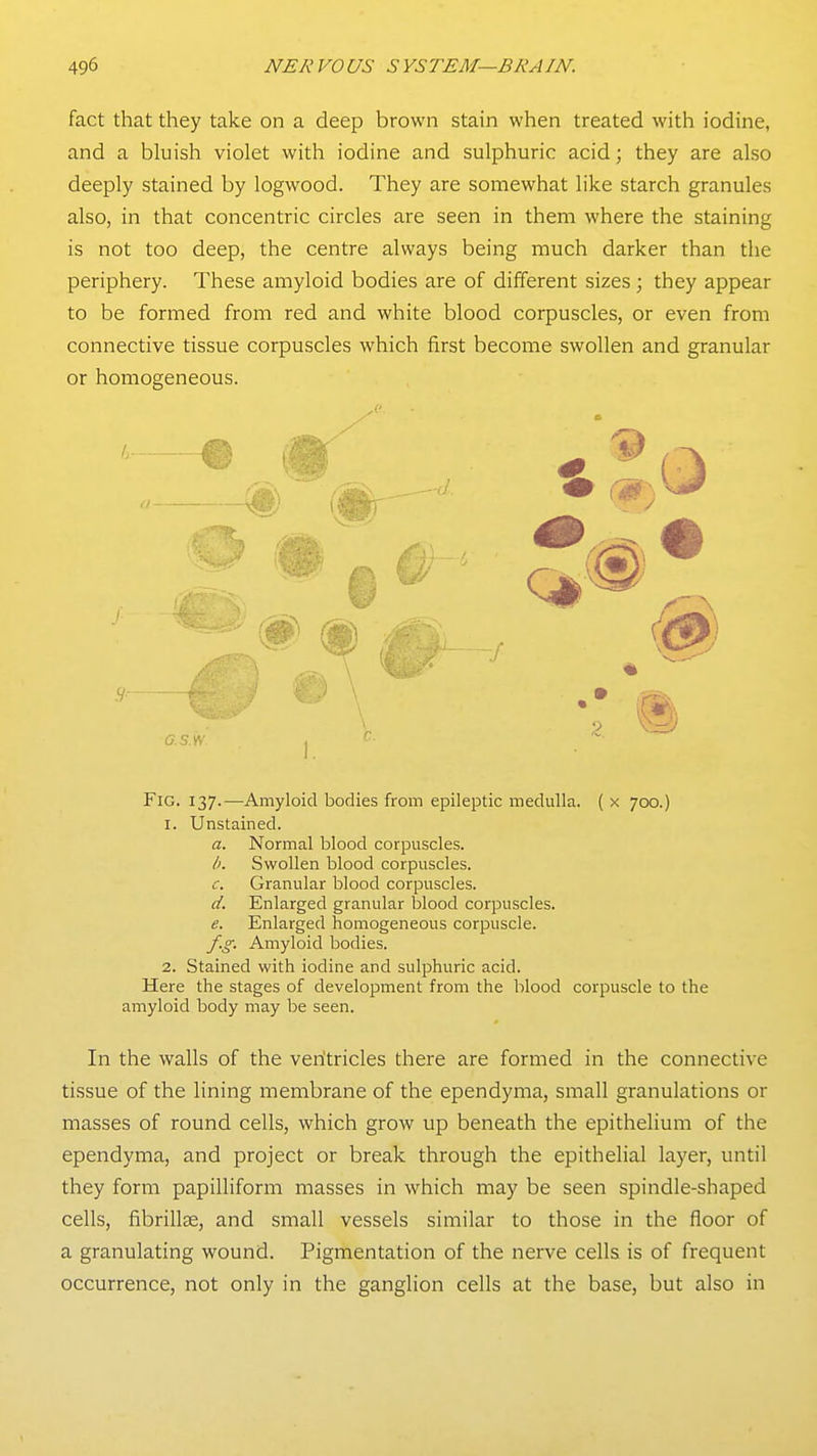 fact that they take on a deep brown stain when treated with iodine, and a bluish violet with iodine and sulphuric acid; they are also deeply stained by logwood. They are somewhat like starch granules also, in that concentric circles are seen in them where the staining is not too deep, the centre always being much darker than the periphery. These amyloid bodies are of different sizes; they appear to be formed from red and white blood corpuscles, or even from connective tissue corpuscles which first become swollen and granular or homogeneous. Fig. 137.—Amyloid bodies from epileptic medulla. ( x 700.) 1. Unstained. a. Normal blood corpuscles. li. Swollen blood corpuscles. Granular blood corpuscles. d. Enlarged granular blood corpuscles. e. Enlarged homogeneous corpuscle. f.g. Amyloid bodies. 2. Stained with iodine and sulphuric acid. Here the stages of development from the blood corpuscle to the amyloid body may be seen. In the walls of the veritricles there are formed in the connective tissue of the lining membrane of the ependyma, small granulations or masses of round cells, which grow up beneath the epithelium of the ependyma, and project or break through the epithelial layer, until they form papilliform masses in which may be seen spindle-shaped cells, fibrillEe, and small vessels similar to those in the floor of a granulating wound. Pigmentation of the nerve cells is of frequent occurrence, not only in the ganglion cells at the base, but also in