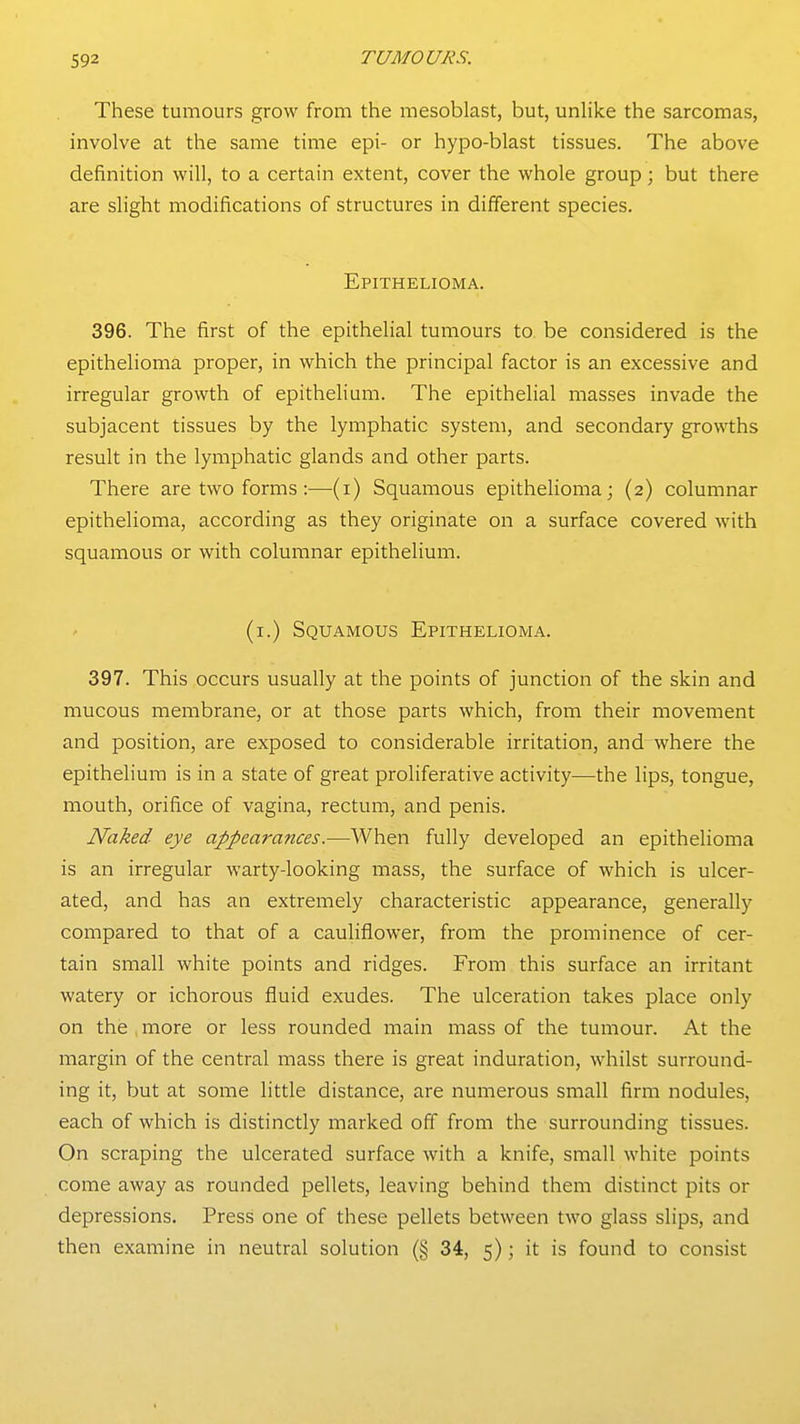These tumours grow from the mesoblast, but, unlike the sarcomas, involve at the same time epi- or hypo-blast tissues. The above definition will, to a certain extent, cover the whole group; but there are slight modifications of structures in different species. Epithelioma. 396. The first of the epithelial tumours to be considered is the epithelioma proper, in which the principal factor is an excessive and irregular growth of epithelium. The epithelial masses invade the subjacent tissues by the lymphatic system, and secondary growths result in the lymphatic glands and other parts. There are two forms :—(i) Squamous epithelioma; (2) columnar epithelioma, according as they originate on a surface covered with squamous or with columnar epithelium. (i.) Squamous Epithelioma. 397. This occurs usually at the points of junction of the skin and mucous membrane, or at those parts which, from their movement and position, are exposed to considerable irritation, and where the epithelium is in a state of great proliferative activity—the lips, tongue, mouth, orifice of vagina, rectum, and penis. Naked eye appearances.—When fully developed an epithelioma is an irregular warty-looking mass, the surface of which is ulcer- ated, and has an extremely characteristic appearance, generally compared to that of a cauliflower, from the prominence of cer- tain small white points and ridges. From this surface an irritant watery or ichorous fluid exudes. The ulceration takes place only on the more or less rounded main mass of the tumour. At the margin of the central mass there is great induration, whilst surround- ing it, but at some little distance, are numerous small firm nodules, each of which is distinctly marked off from the surrounding tissues. On scraping the ulcerated surface with a knife, small white points come away as rounded pellets, leaving behind them distinct pits or depressions. Press one of these pellets between two glass slips, and then examine in neutral solution (§ 34, 5); it is found to consist