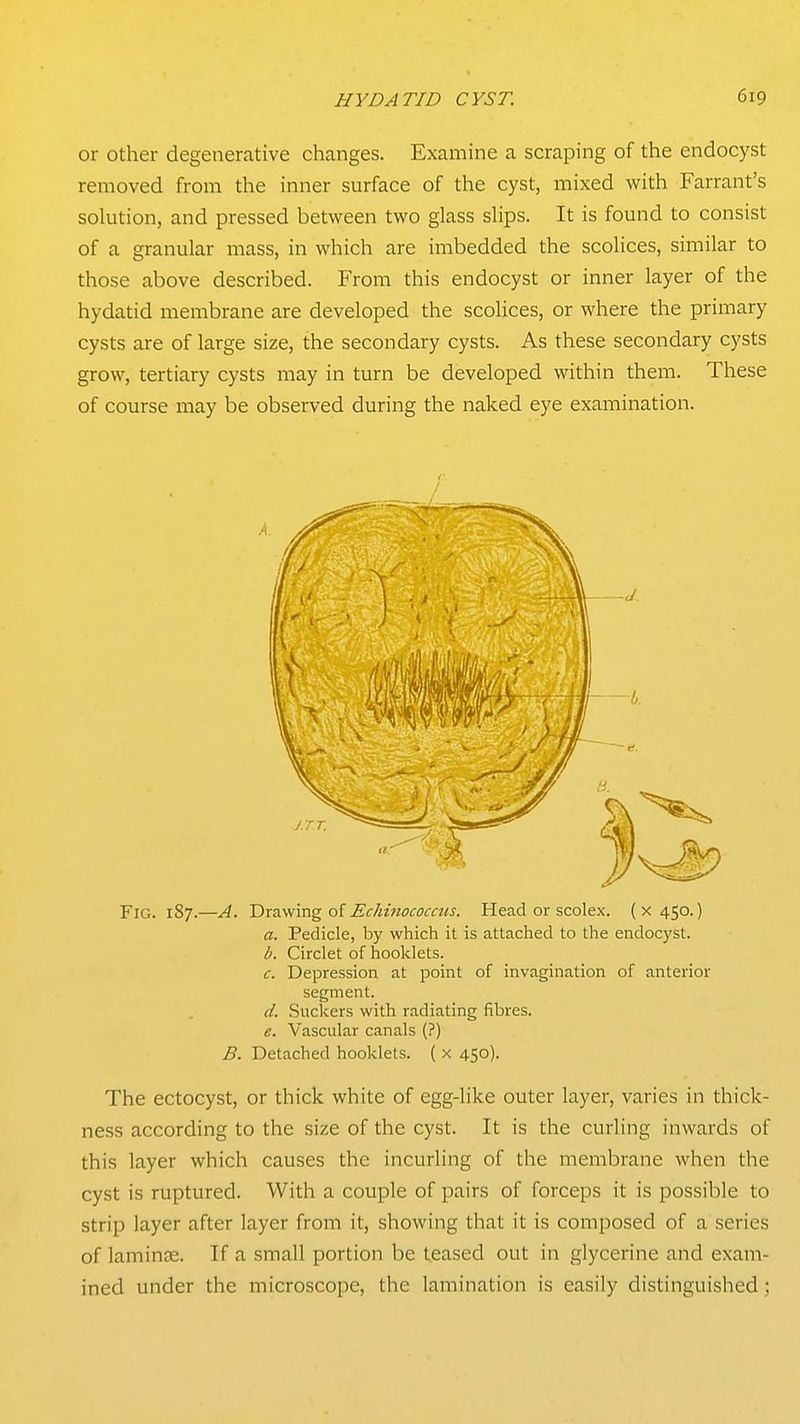 or other degenerative changes. Examine a scraping of the endocyst removed from the inner surface of the cyst, mixed with Farrant's solution, and pressed between two glass slips. It is found to consist of a granular mass, in which are imbedded the scolices, similar to those above described. From this endocyst or inner layer of the hydatid membrane are developed the scolices, or where the primary cysts are of large size, the secondary cysts. As these secondary cysts grow, tertiary cysts may in turn be developed within them. These of course may be observed during the naked eye examination. Fig. 187.—A. Ttrnswrng oi Echinococcus. Head or scolex. (X450.) a. Pedicle, by which it is attached to the endocyst. b. Circlet of hooklets. c. Depression at point of invagination of anterior segment. d. Suckers with radiating fibres. e. Vascular canals (?) B. Detached hooklets. ( x 450). The ectocyst, or thick white of egg-like outer layer, varies in thick- ness according to the size of the cyst. It is the curling inwards of this layer which causes the incurling of the membrane when the cyst is ruptured. With a couple of pairs of forceps it is possible to strip layer after layer from it, showing that it is composed of a series of laminee. If a small portion be teased out in glycerine and exam- ined under the microscope, the lamination is easily distinguished;
