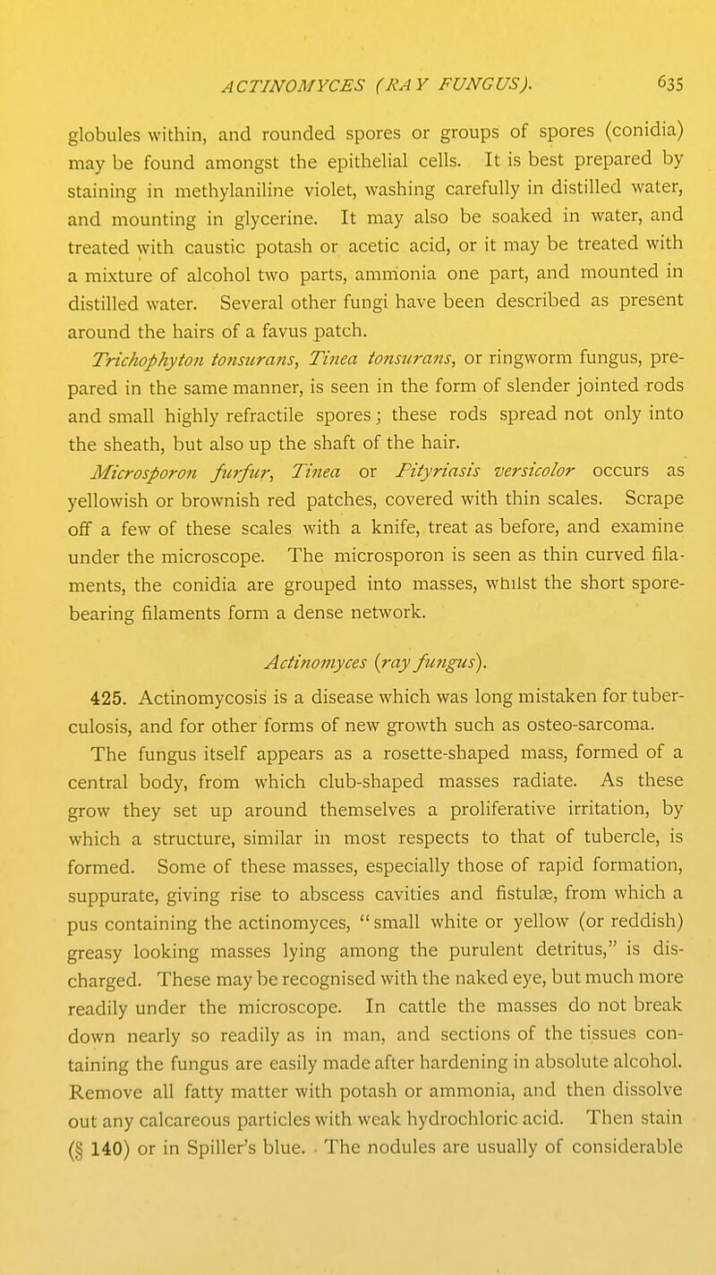 globules within, and rounded spores or groups of spores (conidia) may be found amongst the epithelial cells. It is best prepared by staining in methylaniline violet, washing carefully in distilled water, and mounting in glycerine. It may also be soaked in water, and treated with caustic potash or acetic acid, or it may be treated with a mixture of alcohol two parts, ammonia one part, and mounted in distilled water. Several other fungi have been described as present around the hairs of a favus patch. Trichophyto7i tonsurans, Tinea tonst(rans, or ringworm fungus, pre- pared in the same manner, is seen in the form of slender jointed rods and small highly refractile spores; these rods spread not only into the sheath, but also up the shaft of the hair. Microsporon furfur, Tinea or Pityriasis versicolor occurs as yellowish or brownish red patches, covered with thin scales. Scrape off a few of these scales with a knife, treat as before, and examine under the microscope. The microsporon is seen as thin curved fila- ments, the conidia are grouped into masses, wtiilst the short spore- bearing filaments form a dense network. Actinomyces {ray futigus). 425. Actinomycosis is a disease which was long mistaken for tuber- culosis, and for other forms of new growth such as osteo-sarcoma. The fungus itself appears as a rosette-shaped mass, formed of a central body, from which club-shaped masses radiate. As these grow they set up around themselves a proliferative irritation, by which a structure, similar in most respects to that of tubercle, is formed. Some of these masses, especially those of rapid formation, suppurate, giving rise to abscess cavities and fistulas, from which a pus containing the actinomyces, small white or yellow (or reddish) greasy looking masses lying among the purulent detritus, is dis- charged. These may be recognised with the naked eye, but much more readily under the microscope. In cattle the masses do not break down nearly so readily as in man, and sections of the tissues con- taining the fungus are easily made after hardening in absolute alcohol. Remove all fatty matter with potash or ammonia, and then dissolve out any calcareous particles with weak hydrochloric acid. Then stain (§ 140) or in Spiller's blue. • The nodules are usually of considerable