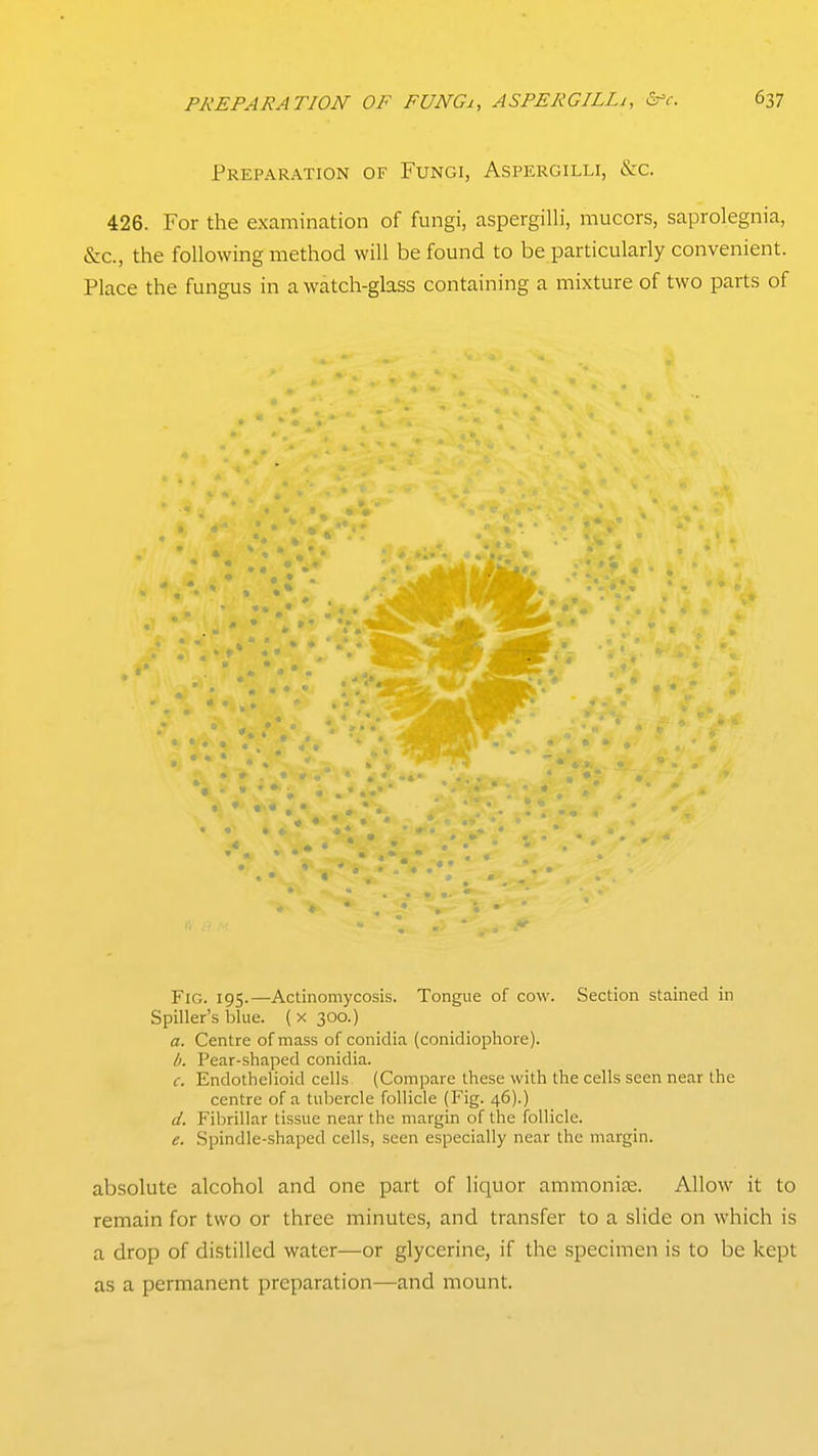 Preparation of Fungi, Aspergilli, &c. 426. For the examination of fungi, aspergilli, mucors, saprolegnia, &c., the following method will be found to be particularly convenient. Place the fungus in a watch-glass containing a mixture of two parts of Fig. 195.—Actinomycosis. Tongue of cow. Section stained in Spiller's blue. ( x 300.) a. Centre of mass of conidia (conidiophore). h. Pear-shaped conidia. c. Endothelioid cells (Compare these with the cells seen near the centre of a tubercle follicle (Fig. 46).) d. Fibrillar tissue near the margin of the follicle. e. Spindle-shaped cells, seen especially near the margin. absolute alcohol and one part of liquor ammonite. Allow it to remain for two or three minutes, and transfer to a slide on which is a drop of distilled water—or glycerine, if the specimen is to be kept as a permanent preparation—and mount.