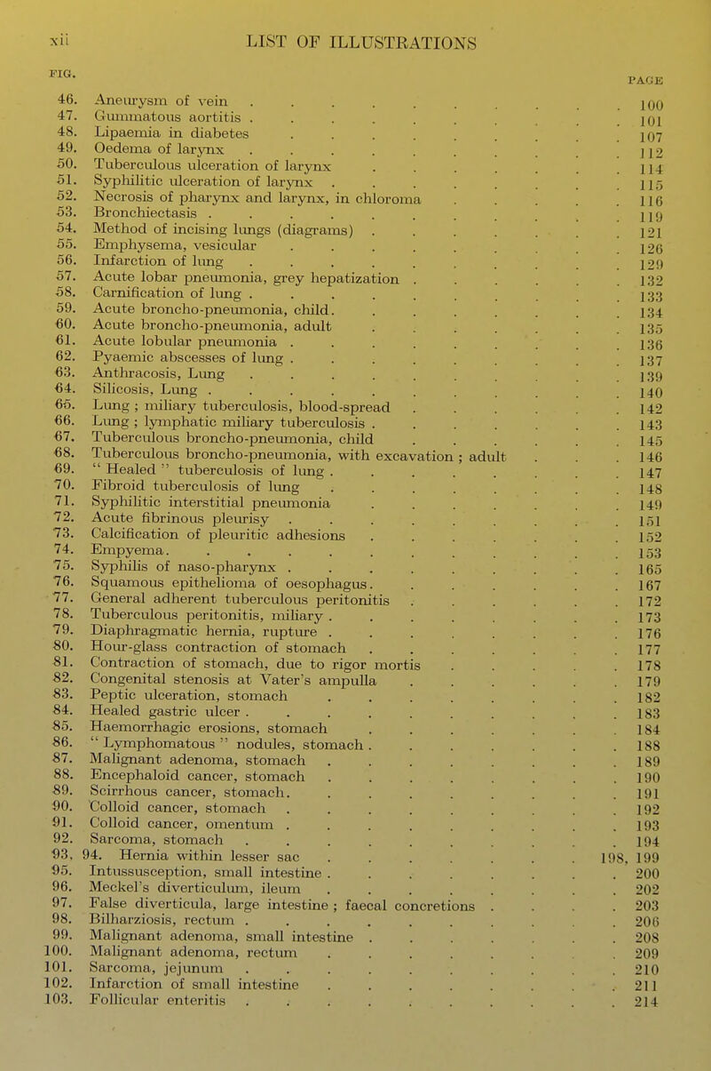 46. Aneurysm of vein ........ 100 47. Gummatous aortitis ....... 101 48. Lipaemia in diabetes ... . ]07 49. Oedema of larynx ...... j j ■> 50. Tuberculous ulceration of larynx . . . . . U4 51. Syphilitic ulceration of larynx ..... H5 52. Necrosis of pharynx and larynx, in chloroma . . . 116 53. Bronchiectasis ......... 119 54. Method of incising lungs (diagrams) . . . . . .121 55. Emphysema, vesicular ..... 126 56. Infarction of lung ..... . . ] ■> \ i 57. Acute lobar pneumonia, grey hepatization .... 132 58. Carnification of lung ...... 133 59. Acute broncho-pneumonia, child. ...... 134 •60. Acute broncho-pneumonia, adult ..... 135 61. Acute lobular pneumonia ....... 136 62. Pyaemic abscesses of lung ..... 137 63. Anthracosis, Lung ...... 139 64. Silicosis, Lung ......... 140 65. Lung; miliary tuberculosis, blood-spread .... .142 66. Lung ; lymphatic miliary tuberculosis .... 143 67. Tuberculous broncho-pneumonia, child . . . . . .145 68. Tuberculous broncho-pneumonia, with excavation; adult . .146 69.  Healed  tuberculosis of lung ..... . . 147 70. Fibroid tuberculosis of lung . . . . . . . .148 71. Syphilitic interstitial pneumonia ...... 149 72. Acute fibrinous pleurisy . . . . . . . . .151 73. Calcification of pleuritic adhesions . . . . . . .152 74. Empyema 153 75. Syphilis of naso-pharynx . . . . . . . . .165 76. Squamous epithelioma of oesophagus. . . . . . .167 77. General adherent tuberculous peritonitis . . . . . .172 78. Tuberculous peritonitis, miliary ...... .173 79. Diaphragmatic hernia, rupture . . . . . . . .176 80. Hour-glass contraction of stomach . . . . . .177 81. Contraction of stomach, due to rigor mortis ... . 178 82. Congenital stenosis at Vater's ampulla . . . . . .179 83. Peptic ulceration, stomach . . . . . . . .182 84. Healed gastric ulcer ........ .183 85. Haemorrhagic erosions, stomach ... 184 86.  Lymphomatous  nodules, stomach. . . ... 188 87. Malignant adenoma, stomach . . . . . . .189 88. Encephaloid cancer, stomach . . . . . . . .190 89. Scirrhous cancer, stomach. . . . . . . . .191 90. Colloid cancer, stomach . . . . . . .192 91. Colloid cancer, omentum . . . . . . . . .193 92. Sarcoma, stomach ...... . 194 93. 94. Hernia within lesser sac . . . . . . 198, 199 95. Intussusception, small intestine ........ 200 96. Meckel's diverticulum, ileum ..... . 202 97. False diverticula, large intestine; faecal concretions . . 203 98. Bilharziosis, rectum .......... 206 99. Malignant adenoma, small intestine .... . . 208 100. Malignant adenoma, rectum ...... . 209 101. Sarcoma, jejunum .......... 210 102. Infarction of small intestine ...... .211 103. Follicular enteritis . . . . . . . . . .214