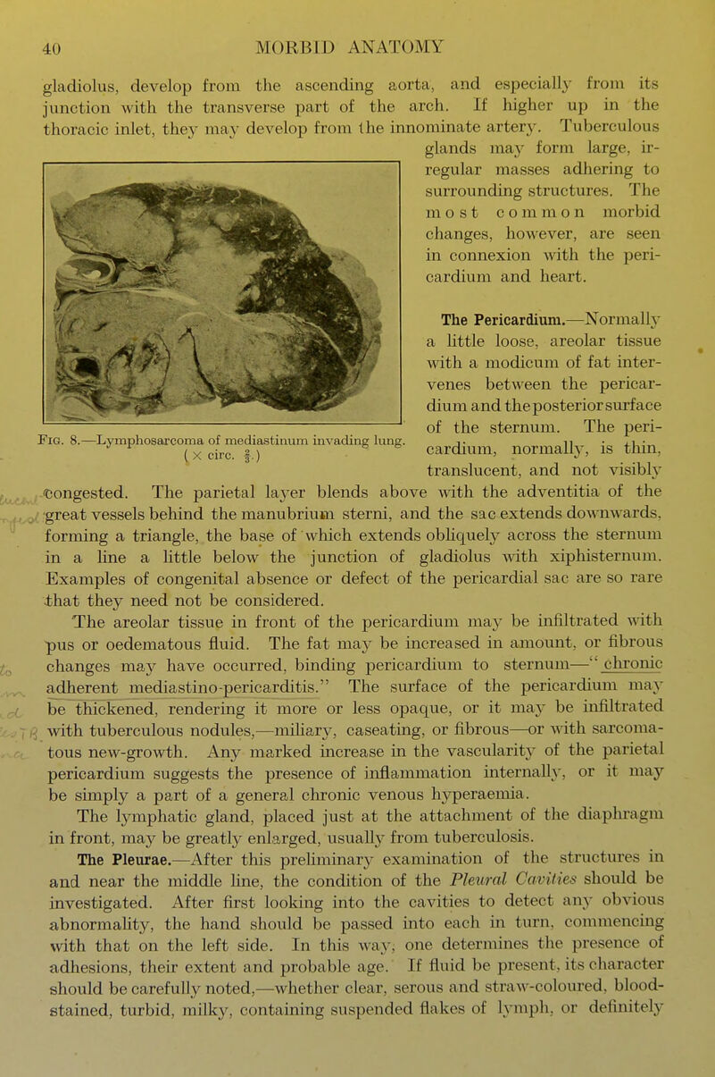 gladiolus, develop from the ascending aorta, and especially from its junction with the transverse part of the arch. If higher up in the thoracic inlet, they may develop from the innominate artery. Tuberculous glands may form large, ir- regular masses adhering to surrounding structures. The most common morbid changes, however, are seen in connexion with the peri- cardium and heart. The Pericardium.—Normally a little loose, areolar tissue with a modicum of fat inter- venes between the pericar- dium and the posterior surface of the sternum. The peri- cardium, normally, is thin, translucent, and not visibly 'Congested. The parietal layer blends above with the adventitia of the great vessels behind the manubrium sterni, and the sac extends downwards, forming a triangle, the base of which extends obliquely across the sternum in a line a little below the junction of gladiolus with xiphisternum. Examples of congenital absence or defect of the pericardial sac are so rare that they need not be considered. The areolar tissue in front of the pericardium may be infiltrated with pus or oedematous fluid. The fat may be increased in amount, or fibrous changes may have occurred, binding pericardium to sternum— chronic adherent mediastino-pericarditis. The surface of the pericardium may be thickened, rendering it more or less opaque, or it may be infiltrated with tuberculous nodules,—miliary, caseating, or fibrous—or with sarcoma- tous new-growth. Any marked increase in the vascularity of the parietal pericardium suggests the presence of inflammation internally, or it may be simply a part of a general chronic venous hyperaemia. The lymphatic gland, placed just at the attachment of the diaphragm in front, may be greatly enlarged, usually from tuberculosis. The Pleurae.—After this preliminary examination of the structures in and near the middle line, the condition of the Pleural Cavities should be investigated. After first looking into the cavities to detect any obvious abnormality, the hand should be passed into each in turn, commencing with that on the left side. In this way; one determines the presence of adhesions, their extent and probable age. If fluid be present , its character should be carefully noted,—whether clear, serous and straw-coloured, blood- stained, turbid, milky, containing suspended Hakes of lymph, or definitely Fig. 8.—Lymphosarcoma of mediastinum invading lung. ( X circ. f.)