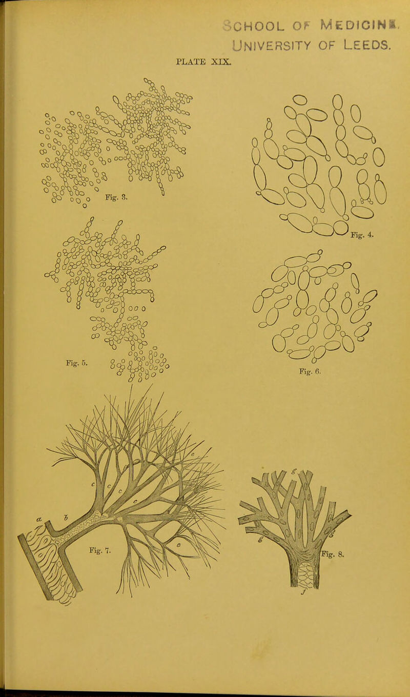School of Medicini. University of Leeds. PLATE XDL