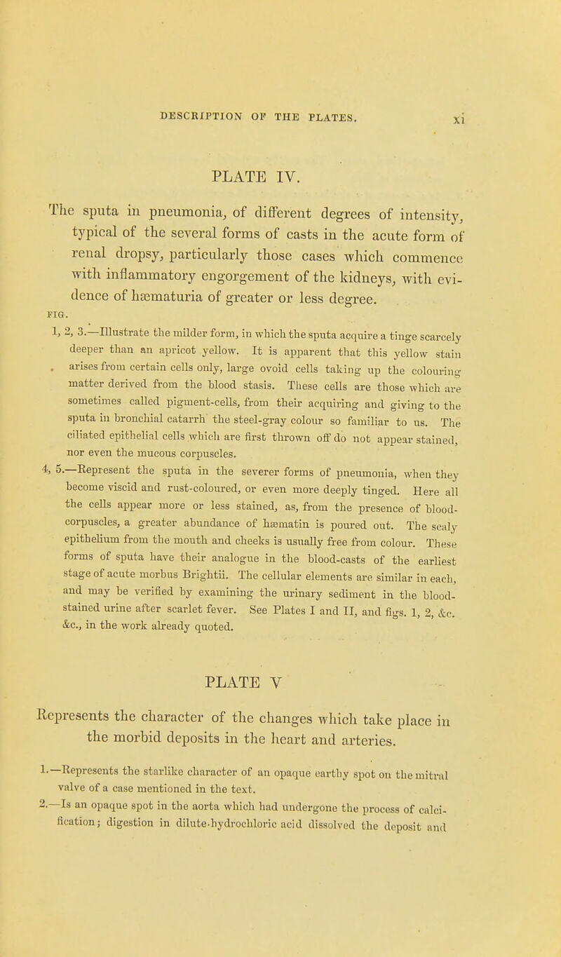 PLATE IV. The sputa in pneumonia, of difl^rent degrees of intensity, typical of the several forms of casts in the acute form of renal dropsy, particularly those cases which commence with inflammatory engorgement of the kidneys, with evi- dence of hajmaturia of greater or less degree. Fia. 1, 2, 3.—Illustrate the milder form, in which the sputa acquire a tinge scarcely deeper than an apricot yellow. It is apparent that this yellow stain . arises from certain cells only, large ovoid cells taking up the colouring matter derived from the hlood stasis. These cells are those which are sometimes called pigment-ceUs, from their acquiring and giving to the sputa in hronchial catarrh the steel-gray coloiu- so familiar to us. The ciliated epithelial cells which are first thrown off do not appear stained, nor even the mucous corpuscles, t, 5.—Represent the sputa in the severer forms of pneumonia, when they become viscid and rust-coloured, or even more deeply tinged. Here all the cells appear more or less stained, as, from the presence of blood- corpuscles, a greater abundance of hajmatin is poured out. The scaly epithelium from the mouth and cheeks is usually free from colour. These forms of sputa have their analogue in the blood-casts of the earliest stage of acute morbus Brightii. The cellular elements are similar in each, and may be verified by examining the urinary sediment in tlie blood- stained urine after scarlet fever. See Plates I and II, and figs. 1, 2, &c. &c., in the work already quoted. PLATE V Represents the character of the changes which take place in the morbid deposits in the heart and arteries. 1. —Represents the starlike character of an opaque earthy spot on the mitral valve of a case mentioned in the text. 2. —Is an opaque spot in the aorta which had undergone the process of calci- fication; digestion in dilute-hydrochloric acid dissolved the deposit and