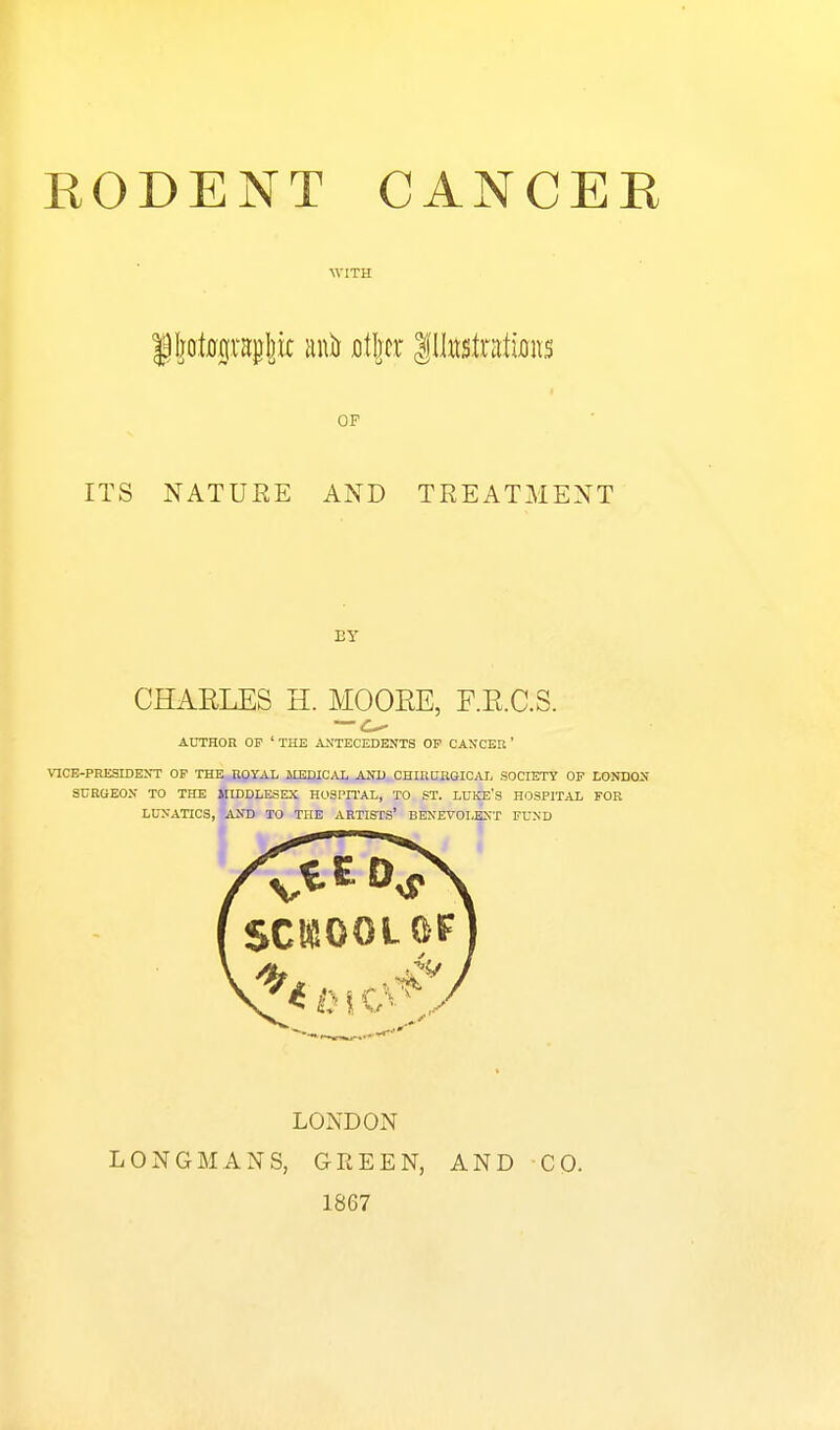 WITH OF ITS NATUEE AND TREATMENT BY CHARLES H. MOOEE, F.E.C.S. AUTHOR OF ' THE ANTECEDENTS OP CANOEB ' VICE-PRESIDENT OF THE ROYAL MJ3DICAL AtO) CHinUUGIOAI, SOCIETY OP LONDON SURGEON TO THE MIDDLESEX HOSPITAL, TO ST. LUKE'S HOSPITAL FOR LUNATICS, AND TO THE ARTISTS' BENEVOLENT FUND LONDON LONGMANS, GEEEN, 1867 AND CO.