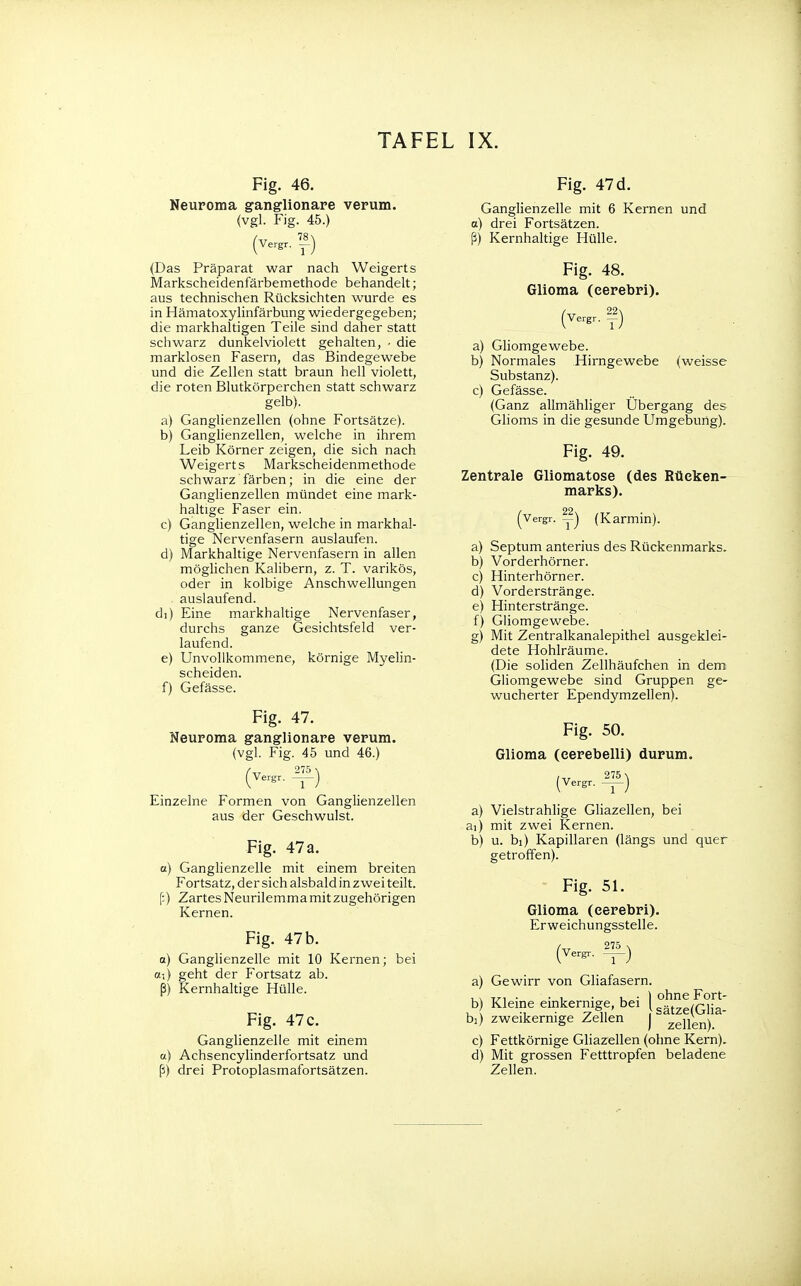 Fig. 46. Neuroma ganglionare verum. (vgl. Fig. 45.) (Verg, 7f) (Das Präparat war nach Weigerts Markscheidenfärbemethode behandelt; aus technischen Rücksichten wurde es in Hämatoxylinfärbung wiedergegeben; die markhaltigen Teile sind daher statt schwarz dunkelviolett gehalten, ■ die marklosen Fasern, das Bindegewebe und die Zellen statt braun hell violett, die roten Blutkörperchen statt schwarz gelb). a) Ganglienzellen (ohne Fortsätze). b) Ganglienzellen, welche in ihrem Leib Körner zeigen, die sich nach Weigert s Markscheidenmethode schwarz färben; in die eine der Ganglienzellen mündet eine mark- haltige Faser ein. c) Ganglienzellen, welche in markhal- tige Nervenfasern auslaufen. d) Markhaltige Nervenfasern in allen möglichen Kalibern, z. T. varikös, oder in kolbige Anschwellungen auslaufend. di) Eine markhaltige Nervenfaser, durchs ganze Gesichtsfeld ver- laufend. e) Unvollkommene, körnige Myelin- scheiden. f) Gefässe. Fig. 47. Neuroma ganglionare verum. (vgl. Fig. 45 und 46.) (Verg, iE) Einzelne Formen von Ganglienzellen aus der Geschwulst. Fig. 47 a. a) Ganglienzelle mit einem breiten Fortsatz, der sich alsbald inz wei teilt. [;) Zartes Neurilemma mit zugehörigen Kernen. Fig. 47 b. et-,) geht der Fortsatz ab. ß) Kernhaltige Hülle. Fig. 47 c. Ganglienzelle mit einem <x) Achsencylinderfortsatz und ß) drei Protoplasmafortsätzen. Fig. 47 d. Ganglienzelle mit 6 Kernen und a) drei Fortsätzen, ß) Kernhaltige Hülle. Fig. 48. Glioma (eerebri). (Vergr. a) Gliomgewebe. b) Normales Hirngewebe (weisse Substanz). c) Gefässe. (Ganz allmähliger Übergang des Glioms in die gesunde Umgebung). Fig. 49. Zentrale Gliomatose (des Rücken- marks). (vergr. -■) (Karmin). a) Septum anterius des Rückenmarks. b) Vorderhörner. c) Hinterhörner. d) Vorderstränge. e) Hinterstränge. f) Gliomgewebe. g) Mit Zentralkanalepithel ausgeklei- dete Hohlräume. (Die soliden Zellhäufchen in dem Gliomgewebe sind Gruppen ge- wucherter Ependymzellen). Fig. 50. Glioma (eerebelli) durum. 275 < Vergr. I Ib \ a) Vielstrahlige Gliazellen, bei ai) mit zwei Kernen. b) u. bi) Kapillaren (längs und quer getroffen). Fig. 51. Glioma (eerebri). Erweichungsstelle. 275 \ a) Gewirr von Gliafasern. b) Kleine einkernige, bei (^(GhV bi) zweikernige Zellen j zeljen\ c) Fettkörnige Gliazellen (ohne Kern). d) Mit grossen Fetttropfen beladene Zellen.