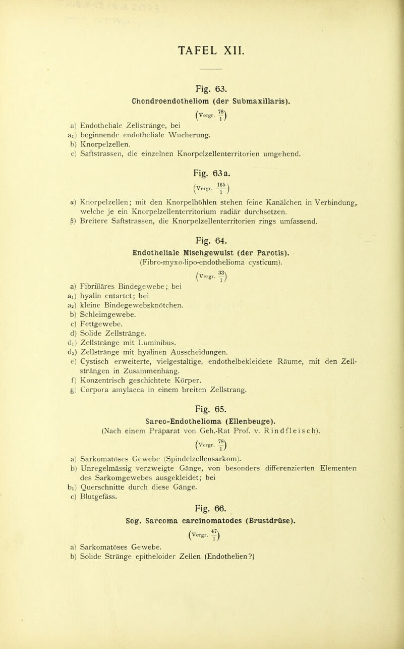 Fig. 63. Chondroendotheliom (der Submaxillaris). (vergr. a) Endotheliale Zellstränge, bei ai) beginnende endotheliale Wucherung. b) Knorpelzellen. c) Saftstrassen, die einzelnen Knorpelzellenterritorien umgehend. Fig. 63 a. (^VergT. —-—J et) Knorpelzellen; mit den Knorpelhöhlen stehen feine Kanälehen in Verbindung,, welche je ein Knorpelzellenterritorium radiär durchsetzen, ß) Breitere Saftstrassen, die Knorpelzellenterritorien rings umfassend. Fig. 64. Endotheliale Misehgewulst (der Parotis). (Fibro-myxo-lipo-endothelioma cysticum). (Vergr. f) a) Fibrilläres Bindegewebe; bei ai) hyalin entartet; bei a2) kleine Bindegewebsknötchen. b) Schleimgewebe. c) Fettgewebe. d) Solide Zellstränge. di) Zellstränge mit Luminibus. d2) Zellstränge mit hyalinen Ausscheidungen. e) Cystisch erweiterte, vielgestaltige, endothelbekleidete Räume, mit den Zell- strängen in Zusammenhang. f) Konzentrisch geschichtete Körper. g) Corpora amylacea in einem breiten Zellstrang. Fig. 65. Sareo-Endothelioma (Ellenbeuge). (Nach einem Präparat von Geh.-Rat Prof. v. Rindfleisch). (Vergr. ») a) Sarkomatöses Gewebe (Spindelzellensarkom). b) Unregelmässig verzweigte Gänge, von besonders differenzierten Elementen des Sarkomgewebes ausgekleidet; bei bi) Querschnitte durch diese Gänge. c) Blutgefäss. Fig. 66. Sog. Sareoma earcinomatodes (Brustdrüse). (Vergr. I7) a) Sarkomatöses Gewebe. b) Solide Stränge epitheloider Zellen (Endothelien ?)