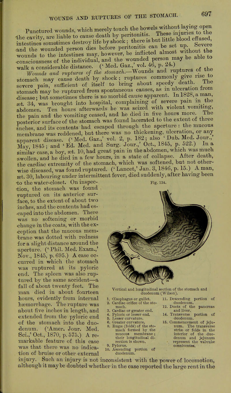 WOUNDS AND RUPTURES OF THE STOMACH. Fig. 134. Punctured wounds, which merely touch the l^o^-;^*.^^^ •the cavity, are liable to cause death by peritonitis., These m^^^^^^^ intestines sometimes destroy life by shock; there is ^'^^^ l^/';^^^ Xv^^^ and the wounded person dies before peritonitis can be set ^^^^^^ wounds to the intestines may, however, be inflicted ^^^^^^ .<3onsciousness of the individual, and the wounded person may be able to walk a considerable distance. (' Med. Gaz. vol. 46, V-^^•) ^ Wounds and ruptures of the stomach.-Wouj^ds and raptures ot the stomach may caufe death by shock ; ruptures commonly give use to severe pain, sufficient of itself to bring about speedy death. ihe stomach may be ruptured from spontaneous causes, as m ulceration from disease; but sometimes there is no morbid cause apparent, in 182«, a man, ffit. 34, was brought into hospital, complaining of severe pam m the abdomen. Ten hours afterwards be was seized with violent vomitmg, the pain and the vomiting ceased, and he died in five hours more ihe posterior surface of the stomach was found lacerated to the extent of three inches, and its contents had escaped through the aperture : the mucous membrane was reddened, but there was no thickening ulceration, or any apparent disease. ('Med. Gaz.,' vol. 2, p. ; also ' Dub. Med Jour., May 1845; and 'Ed. Med. and Surg. Jour.,' Oct., 1845, p. 522.) In a similar case, a boy, ff)t. 10, had great pain in the abdomen, which was much swollen, and he died in a few hours, in a state of collapse. After death, the cardiac extremity of the stomach, which was softened, but not other- wise diseased, was found ruptured. (' Lancet,' Jan. 3,184b, p. 15.) A man, set. 30, labouring under intermittent fever, died suddenly, after having been iio the water-closet. On inspec- tion, the stomach was found ruptured on its anterior sur- face, to the extent of about two inches, and the contents had es- caped into the abdomen. There was no softening or morbid ■change in the coats, with the ex- ception that the mucous mem- 'brane was dotted with redness for a slight distance around the •aperture. (' Phil. Med. Exam.,' Nov., 1845, p. 695.) A case oc- curred in which the stomach was ruptured at its pyloric end. The spleen was also rup- tured by the same accident—a fall of about twenty feet. The man died in about fourteen hours, evidently from internal hsemorrhage. The rupture was about five inches in length, and extended from the pyloric end of the stomach into the duo- denum. ('Amer. Jour. Med. Sci.,' Oct., 1870, p. 575.) A re- markable feature of this case was that there was no indica- tion of bruise or other external injury. Such an injury is not inconsistent with the power of locomotion, although it maybe doubted whether in the case reported the large rent in the Vertical and longitudinal section of the stomach and duodenum (Wilson). Oesophagus or gullet. Cardiac orifice of the sto mach of 3. Cardiac or greater end. 4. Pyloric or lesser end. 5. Lesser curvature. 6. Greater curvature. 8. Rugfe (folds) of the sto- mach formed by the mucous membrane; their longitudinal di- rection is shown. 9. Pylorus. 10. Ascending portion of duodenum. 11. Descending portion duodenum. 12. Ducts of the pancreas and liver. 14. Transverse portion of duodenum. 15. Commencement of jeju- num. The transverse strise or folds in the interior of the duo- denum and jejunum represent the valvulffi conniventes.