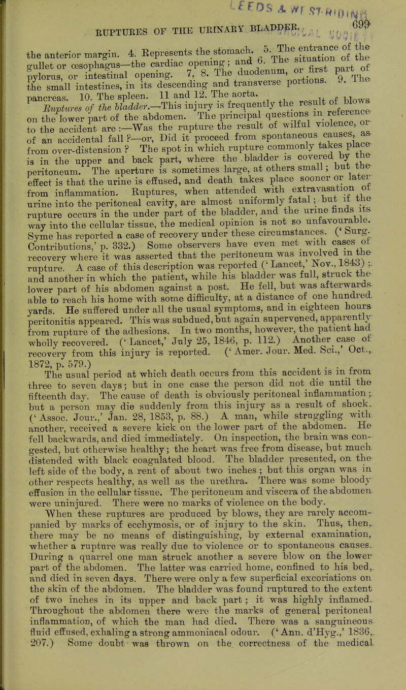 HUPTURES OF THE UEINAEY BLADPER./^^ . ^^^^ the anterior margin. 4. Represents the stomach The J^^^^^^^^^^^ ^^^^ Se' gullet or cBSophagns-the cardiac opemng; and 6. Th ^^^^-H^'j, pylorus, or intestinal opening. 7 8. -^^^ duottenum, u f the small intestines, in its descending and transverse portions, y. pancreas. 10. The spleen. 11 and 12. The aorta. ^ ^ Ez.p^^.re. 0/ hladder.-^This injury is frequently the ^^^^^^ ^J^^^^^^^^ on the lower part of the abdomen. The principal questions ^^^^^^^^ to the accident are :-Was the rupture the result of wilful violence, or of an accidental fall ?-or, Did it proceed from spontaneous causes, a^ from over-distension ? The spot in which rupture commonly takes place is in the upper and back part, where the bladder is covered by the peritoneum. The aperture is sometimes large, at others small; but tue- efEect is that the urine is effused, and death takes place sooner or Jater from inflammation. Ruptures, when attended with extravasation ot urine into the peritoneal cavity, are almost uniformly fatal; but it ine rupture occurs in the under part of the bladder, and the urine finds its way into the cellular tissue, the medical opinion is not so unfavourable. Syme has reported a case of recovery under these circumstances. { burg. Contributions,' p. 332.) Some observers have even met with cases ot recovery where it was asserted that the peritoneum was involved in the rupture. A case of this description was reported (' Lancet Nov., 184d) ;. and another in which the patient, while his bladder was fall, struck the lower part of his abdomen against a post. He fell, but was afterwards- able to reach his home with some difficulty, at a distance of one hundred yards. He suffered under all the usual symptoms, and m eighteen hours peritonitis appeared. This was subdued, but again supervened, apparently from rupture of the adhesions. In two months, however, the patient had wholly recovered. (' Lancet,' July 25, 1846, p. 112.) Another case of recovery from this injury is reported. ('Amer. Jour. Med. Sci., Oct.,. 1872, p. 579.) . . The usual period at which deatli occurs from this accident is m from three to seven days; but in one case the person did not die until the fifteenth day. The cause of death is obviously peritoneal inflammation but a person may die suddenly from this injury as a result of shock. (' Assoc. Jour.,' Jan. 28, 1853, p. 88.) A man, while struggling with another, received a severe kick on the lower part of the abdomen. He fell backwards, and died immediately. On inspection, the brain was con- gested, but otherwise healthy; the heart was free from disease, but muck distended with black coagulated blood. The bladder presented, on the left side of the body, a rent of about two inches ; but this organ was in other respects healthy, as well as the urethra. There was some bloody effusion in the cellular tissue. The peritoneum and viscera of the abdomen were uninjured. There were no marks of violence on the body. When these ruptures are produced by blows, they are rarely accom- panied by marks of ecchymosis, or of injury to the skin. Thus, then, there may be no means of distinguishing, by external examination, whether a rupture was really due to violence or to spontaneous causes. During a quarrel one man struck another a severe blow on the lower part of the abdomen. The latter was carried home, confined to bis bed,, and died in seven days. There were only a few superficial excoriations on the skin of the abdomen. The bladder was found ruptured to the extent of two inches in its upper and back part; it was highly inflamed. Throughout the abdomen there were the marks of general peritoneal inflammation, of which the man had died. There was a sanguineous fluid effused, exhaling a strong ammoniacal odour. (' Ann. d'Hyg.,' 1836,. 207.) Some doubt was thrown on the, correctness of the medical