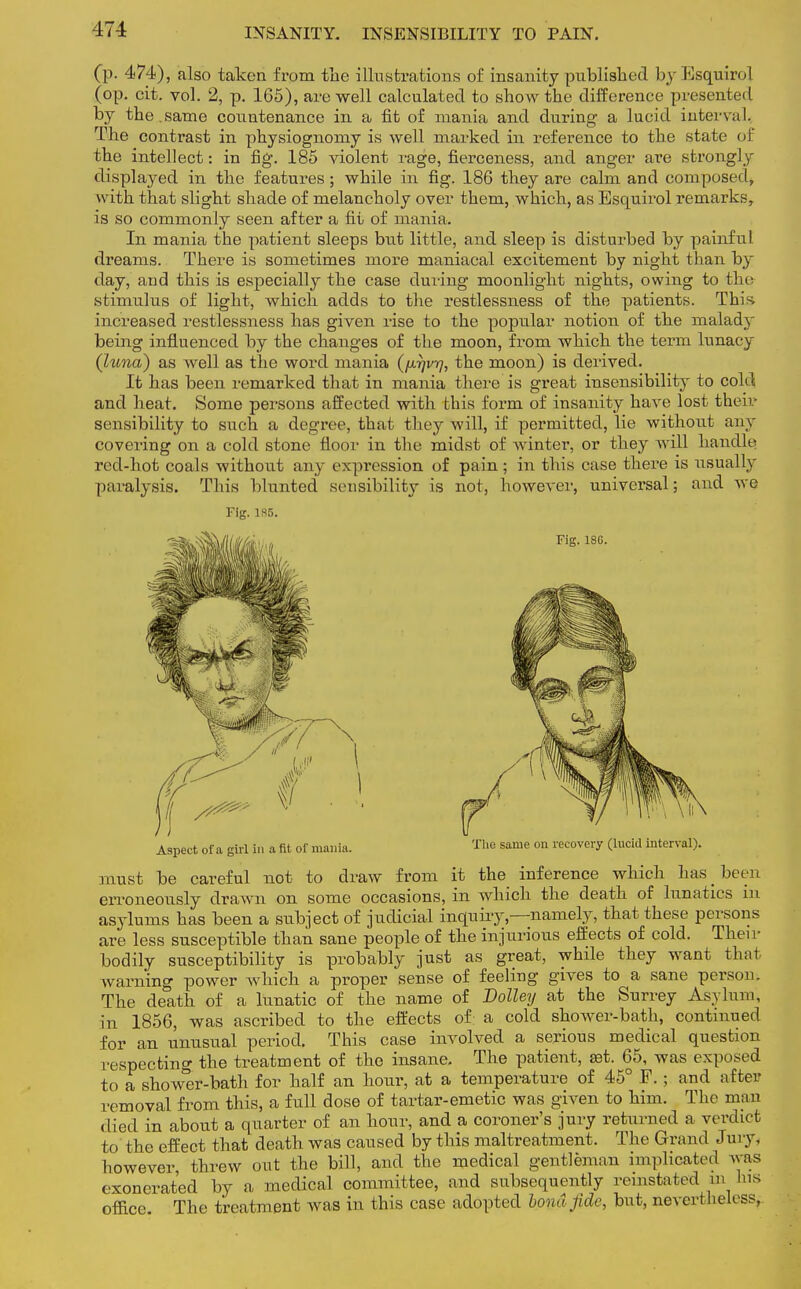 INSANITY. INSENSIBILITY TO PAIN. (p. 474), also taken from the illustrations of insanity published byEsquiro] (op. cit. vol. 2, p. 165), are well calculated to show the difference presented by the.same countenance in a fit of mania and during a lucid interval. The contrast in physiognomy is well marked in reference to the state of the intellect: in fig. 185 violent rage, fierceness, and anger are strongly displayed in the features; while in fig. 186 they are calm and composed, with that slight shade of melancholy over them, which, as Esquirol remarks, is so commonly seen after a fit of mania. In mania the patient sleeps but little, and sleep is disturbed by painful dreams. There is sometimes more maniacal excitement by night than by day, and this is especially the case during moonlight nights, owing to the stimulus of light, which adds to the restlessness of the patients. This, increased restlessness has given rise to the popular notion of the malady being influenced by the changes of the moon, from which the term lunacy (luna) as well as the word mania (fj.rjvrj, the moon) is derived. It has been remarked that in mania there is great insensibility to cold and heat. Some persons affected with this form of insanity have lost their sensibility to such a degree, that they will, if permitted, lie without any covering on a cold stone floor in the midst of winter, or they will handle red-hot coals without any expression of pain; in this case there is usually paralysis. This blunted sensibility is not, however, universal; and we Fig. 1S5. must be careful not to draw from it the inference which has _ been erroneously drawn on some occasions, in which the death of lunatics in asylums has been a subject of judicial inquiry,—namely, that these persons are less susceptible than sane people of the injurious effects of cold. Then- bodily susceptibility is probably just as great, while they want thai warning power which a proper sense of feeling gives to a sane person. The death of a lunatic of the name of Dolley at the Surrey Asylum, in 1856, was ascribed to the effects of a cold shower-bath, continued for an unusual period. This case involved a serious medical question respecting the treatment of the insane. The patient, eet. 65, was exposed to a shower-bath for half an hour, at a temperature of 45° P. ; and after removal from this, a full dose of tartar-emetic was given to him. The man died in about a quarter of an hour, and a coroner's jury returned a verdict to the effect that death was caused by this maltreatment. The Grand Jury, however, threw out the bill, and the medical gentleman implicated was exonerated by a medical committee, and subsequently reinstated an Ins office. The treatment was in this case adopted bond fide, but, nevertheless, Aspect of a girl in a fit of mania. The same on recovery (lucid interval).