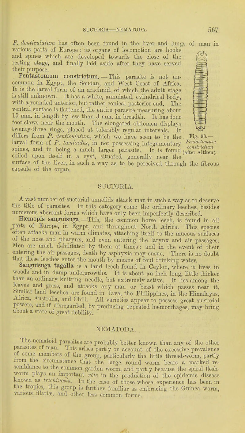 P. denticulatum lias often been found in tlie liver and lungs of man in various parts of Europe: its organs of locomotion are liooks and spines which are developed towards the close of the resting stage, and finally laid aside after they have served their purpose. Pentastomum constrictum. — This parasite is not un- common in Egypt, the Soudan, and West Coast of Africa, It is the larval form of an arachnid, of which the adult stage is still unknown. It has a white, annulated, cyhndrical body, with a rounded anterior, but rather conical posterior end. The ventral surface is flattened, the entire parasite measuring about 15 mm. in length by less than 3 mm. in breadth. It has four foot-claws near the mouth. The elongated abdomen displays twenty-three rings, placed at tolerably regular intervals. It differs from P. denticulatum, which we have seen to be the larval form of P. tcenioides, in not possessing integumentary spines, and in being a much larger parasite. It is found Tig. 98.— Pentastomum constrictum ■ (after Aitken). coiled upon itself in a cyst, situated generally near the surface of the liver, in such a way as to be perceived through the fibrous capsule of the organ. SUCTOEIA. A vast number of suctorial annelids attack man in such a way as to deserve the title of parasites. In this category come the ordinary leeches, besides numerous aberrant forms which have only been imperfectly described. Hgemopis sanguisuga.—This, the common horse leech, is found in all ^parts of Europe, in Egypt, and throughout North Africa. This species often attacks man in warm climates, attaching itself to the mucous surfaces of the nose and pharynx, and even entering the larynx and air passages. Men are much debilitated by them at times: and in the event of their entering the air passages, death by asphyxia may ensue. There is no doubt that these leeches enter the mouth by means of foul drinking water. Sanguisuga tagalla is a land leech found in Ceylon, where it lives in woods and in damp undergrowths. It is about an inch long, little tliicker than an ordinary knitting needle, but extremely active. It lies among the leaves and grass, and attacks any man or beast which passes near it. bimilar land leeches are found in Java, the Philippines, in the Himalayas, Africa, Austraha, and Chili. All varieties appear to possess great suctorial powers, and if disregarded, by producuig repeated htemorrhages, may bring about a state of great debility. NEMATODA. The nematoid parasites are probably better known than any of the other parasites of man. This arises partly on account of the excessive prevalence ot some members of the group, particularly the little thread-worm, partly fromi the circumstance that the large round worm bears a marked re- semblance to the common garden worm, and partly because the spu-al llesh- Avorm plays an important role in the production of the epidemic disease known as trichinods. In the case of those whose experience has been in the tropics, tliis group is further familiar as embracing the Guinea worm, various filaricT, and otlier less common forms.