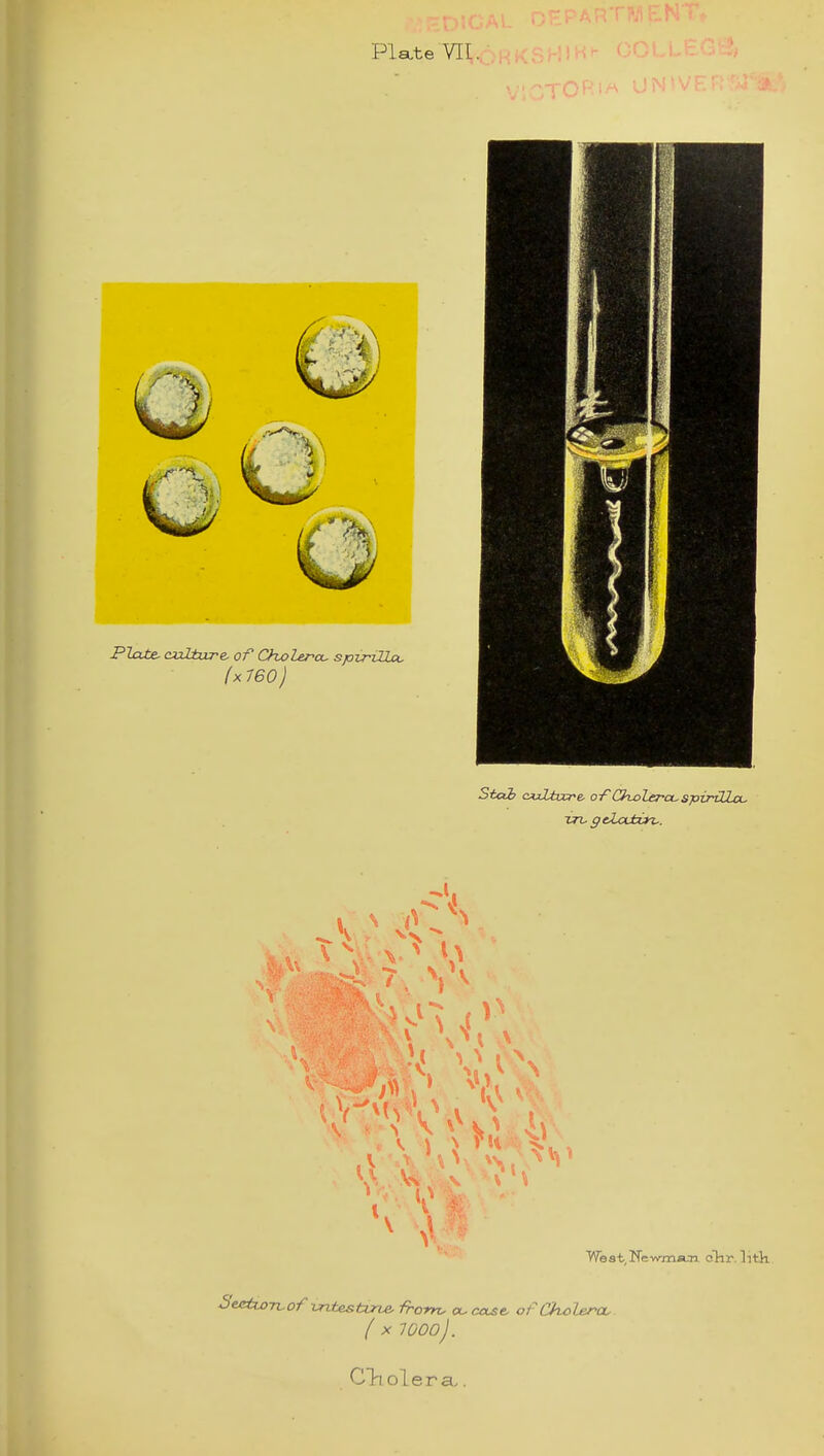 Plate VII. Plcxte. cjxUxcre- of Choler-ou spvriHou (k 760) Stab ciiZiucre. o/Cholera^spirillcL, vn. geZodbOfi,. West Newman. cTir. lith Seetixy-rvof wtesturte, from. ck. cetse, of Cholera. ( X WOOj. Cliol era^.