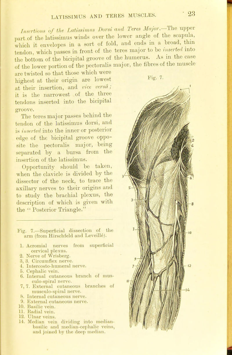 LA.TISSIMUS AND TERES MUSCLES. Fig. 7. liisrrtions of the Latissimns Bvrsi and Teres 3£aJoi:—The upper part of the latissimiis winds over the lower angle of the scapula, which it envelopes in a sort of fold, and ends in a broad, thm tendon, which passes in fi'ont of the teres major to be inserted into the bottom of the bicipital groove of the humerus. As ui the case of the lower portion of the pectoraUs major, the fibres of the muscle are twisted so that those which were highest at their origin are lowest at their insertion, and vice versa; it is the narrowest .of the three tendons inserted into the bicipital groove. The teres major passes behind the tendon of the latissimus dorsi, and is inserted into the inner or posterior edge of the bicipital groove oppo- site the pectoralis major, being separated by a bm-sa from the insertion of the latissimus. Opportunity should be taken, when the clavicle is divided by the dissector of the neck, to trace the axillary nerves to their origins and to study the brachial plexus, the description of which is given with the  Posterior Triangle. Fig. 7.—Supei-ficial dissection of the arm (from Hirsclifeld and Leveille). 1. Acromial nerves from superficial cervical jilexus. 2. Nerve of Wrisberg. '6, 3. Circumflex nerve. '1. Intercosto-lmmeral nerve. 5. Cephalic vein. 6. Internal cutaneous branch of nius- culo-spiral nerve. 7. 7. External cutaneous branches of musculo-s])iral nerve, b. Interniil cutaneous nerve. 0. External cutaneous nerve. 10. Basilic vein. 11. Radial vein. 12. Ulnar veins. 14. Median vein dividing into median- basilic and median-cephalic veins, and joined by the deep median.