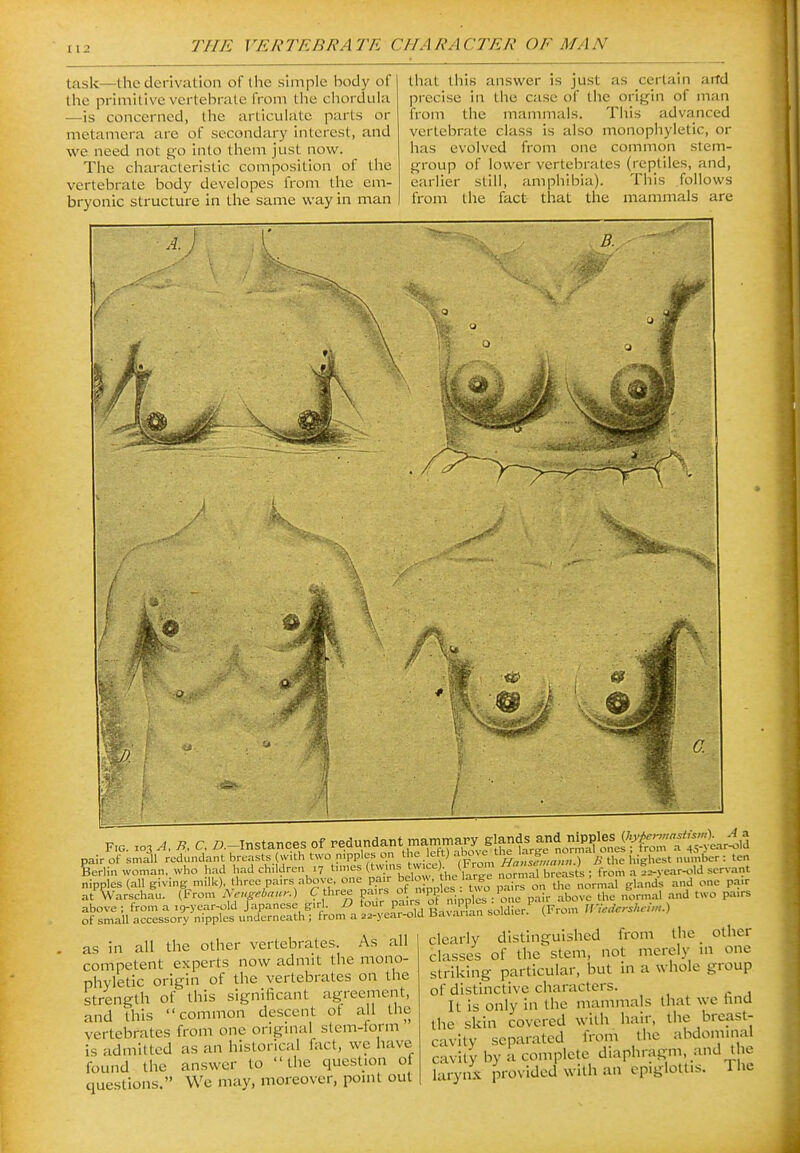 task—the derivation of the shnple body of the primitive vertebrate from the chordula —is concerned, the articulate parts or metamera are of secondary interest, and we need not go into them just now. The characteristic composition of the vertebrate body developes from tlie em- bryonic structure in tlie same way in man that this answer is just as certain arfd precise in the case of tlie origin of man from the mammals. This advanced vertebrate class is also monophyletic, or has evolved from one common stem- group of lower vertebrates (reptiles, and, earlier still, amphibia). This follows from the fact that the mammals are A. F,o. A, B. C, i^.-lnstances Of redundant ma™^^ pair of small redundant breasts (with two nipples on the lett) ^^l^J'^^ '^^^^^ ^ the highest number : ten 6erlin woman, who had had children ,7 ^-^^ ('^/LV'rke'la^^^^^^ from a f^-year-old servant nipples (aU giving milk) three pa,rs above one pa^^^^ i^^j^ a one pa.r at Warschau. (From Aeugebaur.) C three 'Pf o^i-Xs ^one pair above the normal and two pairs above ; from a .9-year-old Japanese girl. ^^^^ Pf^'^j g^,,;Xn sofdier (From iriedershehn.) of small accessory nipples underneath ; from a 22-year-oia oa.\ ai lan s.uiu <= \ as in all the other vertebrates. As all competent experts now admit the mono- phyletic origin of the vertebrates on the strength of this significant agreement, and this common descent of all the vertebrates from one original stem-lorm is admitted as an historical fact, we have found the answer to the question ot questions. We may, moreover, point out clearly distinguished from the other classes of the stem, not merely in one striking particular, but in a whole group of distinctive characters. It is only in the mammals that we tina the skin covered with hair, the breast- cavity separated from the abdominal cavity by a complete diaphragm and the larynx provided with an epiglottis. Ihe