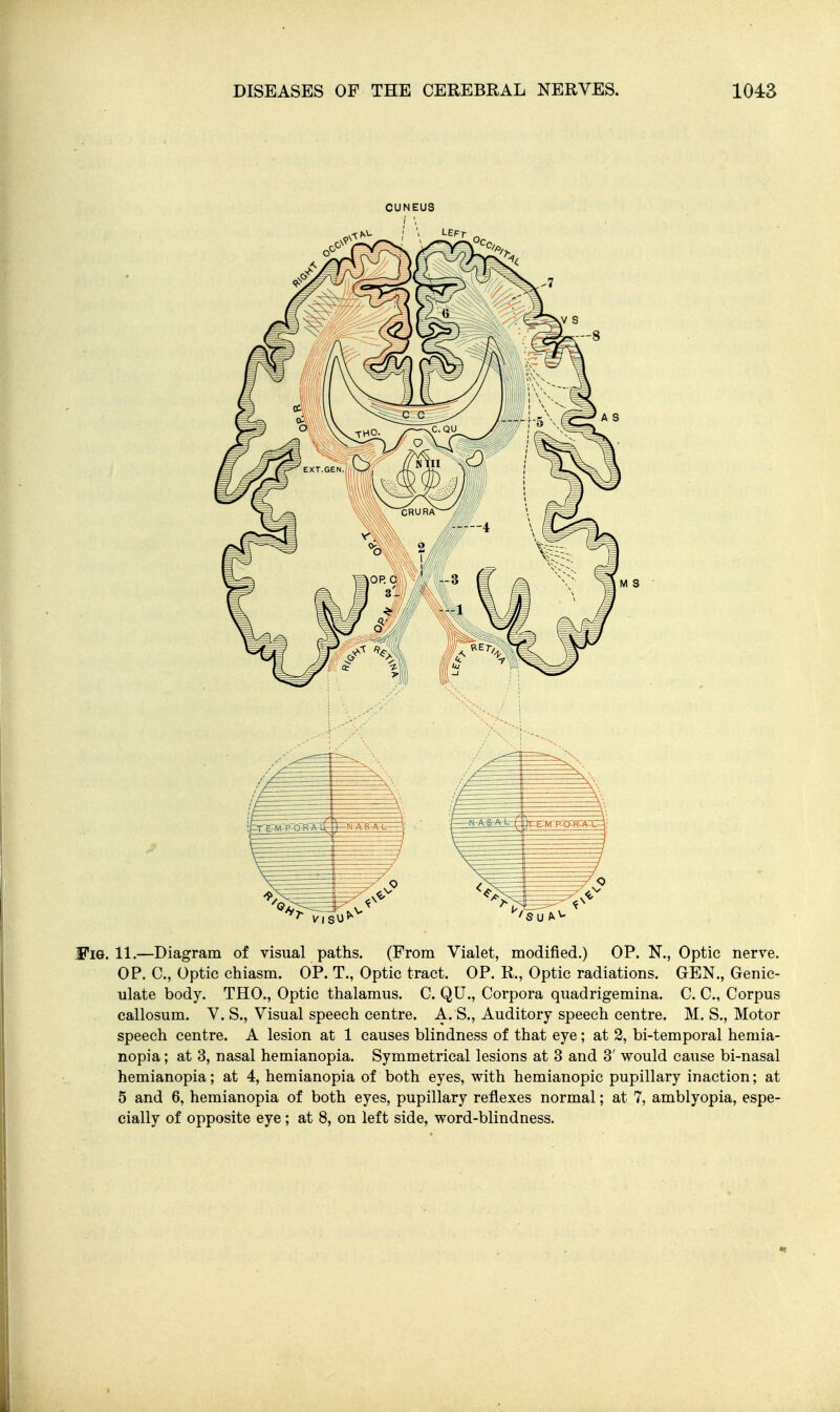 CUNEUS WiGt. 11.—Diagram of visual paths. (From Vialet, modified.) OP. N., Optic nerve. OP. C, Optic chiasm. OP. T., Optic tract. OP. R., Optic radiations. GEN., Genic- ulate body. THO., Optic thalamus. C. QU., Corpora quadrigemina. C. C, Corpus callosum. V. S., Visual speech centre. A. S., Auditory speech centre. M. S., Motor speech centre. A lesion at 1 causes blindness of that eye; at 2, bi-temporal hemia- nopia; at 3, nasal hemianopia. Symmetrical lesions at 3 and 3' would cause bi-nasal hemianopia; at 4, hemianopia of both eyes, with hemianopic pupillary inaction; at 5 and 6, hemianopia of both eyes, pupillary reflexes normal; at 7, amblyopia, espe- cially of opposite eye; at 8, on left side, word-blindness.