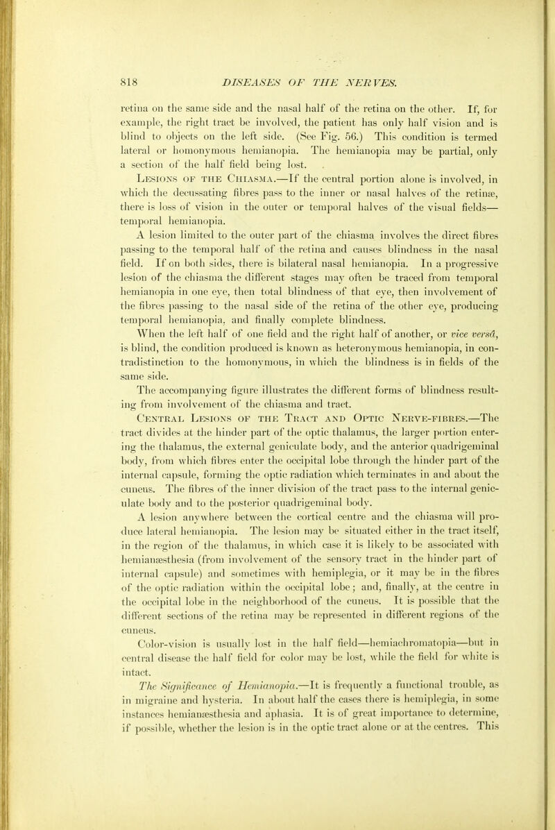 retina on the same side and the nasal half of the retina on the other. If, for example, the right tract be involved, the patient has only half vision and is blind to objects on the left side. (See Fig. 56.) This condition is termed lateral or homonymous hemianopia. The hemianopia may be partial, only a section of the half held being lost. Lesions of the Chiasma.—If the central portion alone is involved, in which the decussating fibres pass to the inner or nasal halves of the retinae, there is loss of vision in the outer or temporal halves of the visual fields— temporal hemianopia. A lesion limited to the outer part of the chiasma involves the direct fibres passing to the temporal half of the retina and causes blindness in the nasal field. If on both sides, there is bilateral nasal hemianopia. In a progressive lesion of the chiasma the different stages may often be traced from temporal hemianopia in one eye, then total blindness of that eye, then involvement of the fibres passing to the nasal side of the retina of the other eye, producing temporal hemianopia. and finally complete blindness. When the left half of one field and the right half of another, or vice versd, is blind, the condition produced is known as heteronymous hemianopia, in con- tradistinction to the homonymous, in which the blindness is in fields of the same side. The accompanying figure illustrates the different forms of blindness result- ing from involvement of the chiasma and tract. Central Lesions of the Tract and Optic Nerve-fibres.—The tract divides at the hinder part of the optic thalamus, the larger portion enter- ing the thalamus, the external geniculate body, and the anterior quadrigeminal body, from which fibres enter the occipital lobe through the hinder part of the internal capsule, forming the optic radiation which terminates in and about the cuneus. The fibres of the inner division of the tract pass to the internal genic- ulate body and to the posterior quadrigeminal body. A lesion anywhere between the cortical centre and the chiasma will pro- duce lateral hemianopia. The lesion may be situated either in the tract itself, in the region of the thalamus, in which case it is likely to be associated with hemianesthesia (from involvement of the sensory tract in the hinder part of internal capsule) and sometimes with hemiplegia, or it may be in the fibres of the optic radiation within the occipital lobe; and, finally, at the centre in the occipital lobe in the neighborhood of the cuneus. It is possible that the different sections of the retina may be represented in different regions of the cuneus. Color-vision is usually lost in the half field—hemiachromatopia—but in central disease the half field for color may be lost, while the field for white is intact. The Significance of Hemianopia.—It is frequently a functional trouble, as in migraine and hysteria. In about half the cases there is hemiplegia, in some instances hemianesthesia and aphasia. It is of great importance to determine, if possible, whether the lesion is in the optic tract alone or at the centres. This