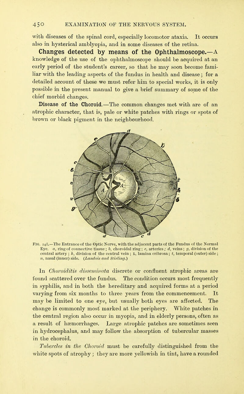 with diseases of the spinal cord, especially locomotor ataxia. It occurs also in hysterical amblyopia, and in some diseases of the retina. Changes detected by means of the Ophthalmoscope.—A knowledge of the use of the ophthalmoscope should be acquired at an early period of the student's career, so that he may soon become fami- liar with the leading aspects of the fundus in health and disease; for a detailed account of these we must refer him to special works, it is only possible in the present manual to give a brief summary of some of the chief morbid changes. Disease of the Choroid.—The common changes met with are of an atrophic character, that is, pale or white patches with rings or spots of brown or black pigment in the neighbourhood. Fig. 248.—The Entrance of the Optic Nerve, with the adjacent parts of the Fundus of the Normal Eye. a, ring of connective tissue ; b, choroidal ring ; c, arteries; <?, veins; g, division of the central artery ; h, division of the central vein ; L, lamina cribrosa; t, temporal (outer) side ; 11, nasal (inner) side. (Landois and Stirling.) In Choroiditis disseminata discrete or confluent atrophic areas are found scattered over the fundus. The condition occurs most frequently in syphilis, and in both the hereditary and acquired forms at a period varying from six months to three years from the commencement. It may be limited to one eye, but usually both eyes are affected. The change is commonly most marked at the periphery. White patches in the central region also occur in myopia, and in elderly persons, often as a result of haemorrhages. Large atrophic patches are sometimes seen in hydrocephalus, and may follow the absorption of tubercular masses in the choroid. Tubercles in the Choroid must be carefully distinguished from the white spots of atrophy ; they are more yellowish in tint, have a rounded