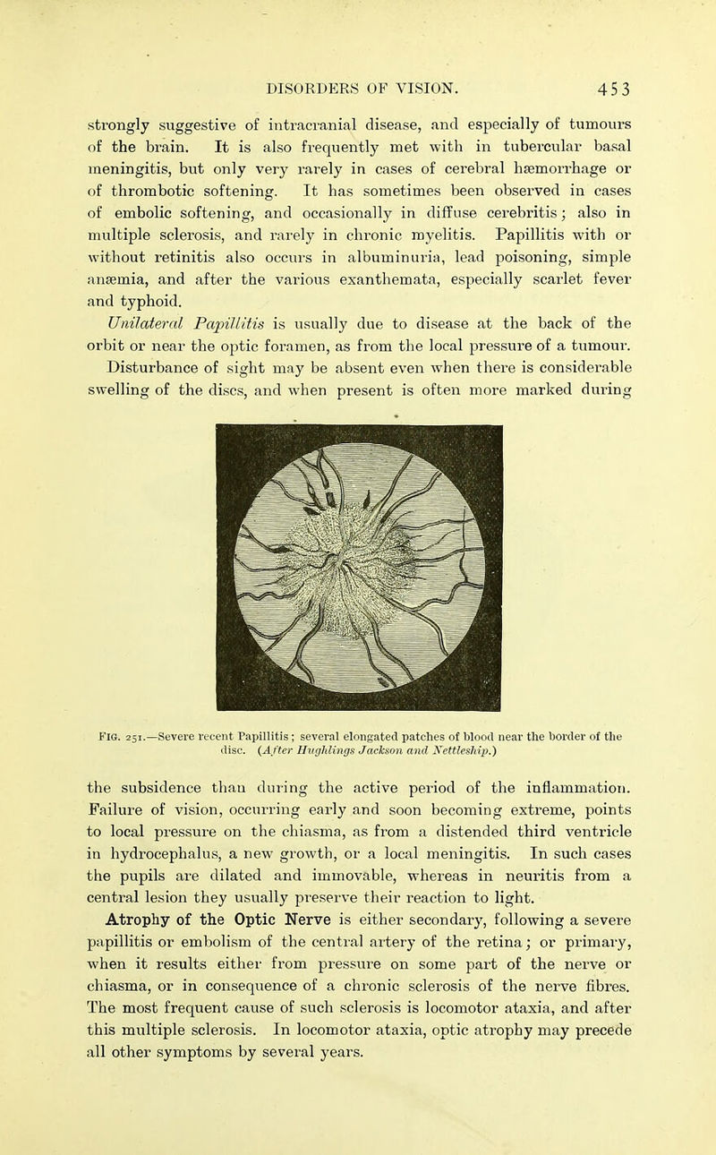strongly suggestive of intracranial disease, and especially of tumours of the brain. It is also frequently met with in tubercular basal meningitis, but only very rarely in cases of cerebral haemorrhage or of thrombotic softening. It has sometimes been observed in cases of embolic softening, and occasionally in diffuse cerebritis; also in multiple sclerosis, and rarely in chronic myelitis. Papillitis with or without retinitis also occurs in albuminuria, lead poisoning, simple anaemia, and after the various exanthemata, especially scarlet fever and typhoid. Unilateral Papillitis is usually due to disease at the back of the orbit or near the optic foramen, as from the local pressure of a tumour. Disturbance of sight may be absent even when there is considerable swelling of the discs, and when present is often more marked during JFig. 251.—Severe recent Papillitis; several elongated patches of blood near the border of the disc. {After Hughlings Jackson and Kettleship.) the subsidence than during the active period of the inflammation. Failure of vision, occurring early and soon becoming extreme, points to local pressure on the chiasma, as from a distended third ventricle in hydrocephalus, a new growth, or a local meningitis. In such cases the pupils are dilated and immovable, whereas in neuritis from a central lesion they usually preserve their reaction to light. Atrophy of the Optic Nerve is either secondary, following a severe papillitis or embolism of the central artery of the retina; or primai-y, when it results either from pressure on some part of the nerve or chiasma, or in consequence of a chronic sclerosis of the nerve fibres. The most frequent cause of such sclerosis is locomotor ataxia, and after this multiple sclerosis. In locomotor ataxia, optic atrophy may precede all other symptoms by several years.