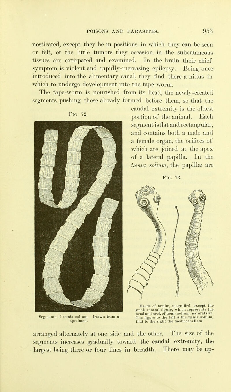 nosticated, except they be in positions in which tliey can be seen or felt, or the little tumors they occasion in the subcutaneous tissues are extirpated and examined. In the brain their chief symptom is violent and rapidly-increasing epilepsy. Being once introduced into the alimentary canal, they find there a nidus in which to undergo development into the tape-worm. The tape-worm is nourished from its head, the newly-created segments pushing those already formed before them, so that the caudal extremity is the oldest portion of the animal. Each segment is flat and rectangular, and contains both a male and a female organ, the orifices of which are joined at the apex of a lateral papilla. In the taenia solium, the papillae are Fig. 73. Fig Segments of tEenia solium. Drawn from a specimen. Heads of t;enioe, magnified, except tVie small central figure, which represents the ln'adand neck of tteni i solium, iiatnral size. The figure to the left is the taenia solium, that to the right the mediocanellata. arranged alternately at one side and the other. The size of the segments increases gradually toward the caudal extremity, the largest being three or four lines in breadth. There may be up-