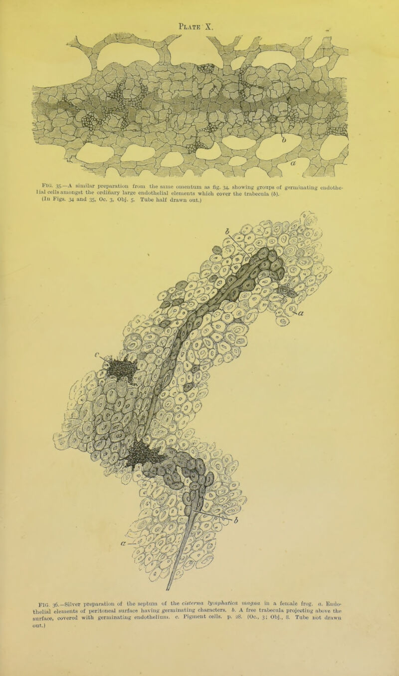 Fig. 35.—a similar preiMnitiuu u-uiii the saniu niiieuluiu as ttg. 34, showing' groups of geriuiiKitiiig tndotliu- lial cells amongst the ortliiiiiry large emlothulial elements which corer the trabecula (i). (lu Figs. 34 and 35, Oc. 3, Obj. 5. Tube half drawn out.) FIO. 36.—Silver preparation of the sei>tuni of the chtrrmi ?;/:iiphiitica miifliin in a female frog. 11. Kiiilo- thelial elements of peritoneal surface having germinating characters. 6. A free trabecula projecting above tin- surface, covered with germinating eiidotheliuni. c. Pigment cells, p. 28. (Oc. 3; Obj., 8. Tube not drawn out.)