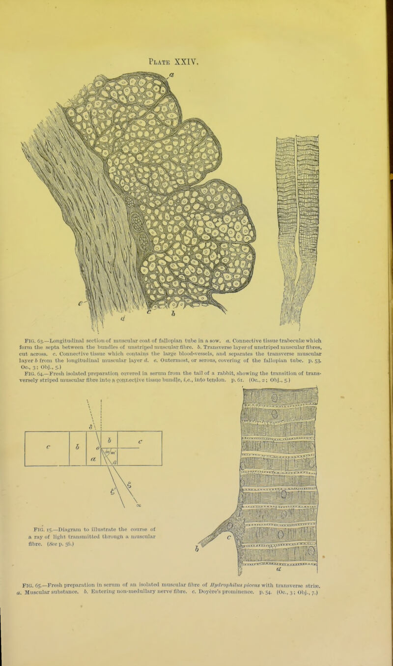 Fig. 63.—Longitmlinal section of mnseuliir coat of fallopian ttibe in a sow. a. Connective tissue traliecula; which form the septa between the buiuUes of imstripetl muscular fibre. 6. Transverse layer of unstriped muscular fibres, cut across, c. Connective tissue which contains the large blood-vessels, and separates the transverse muscular layer b from the longitudinal muscular laj'er U. e. Outermost, or serous, covering of the fallopian tube. p. 53. Oc, 3: Obj., 5 ) FIG. 64.—Fresh isolated prei)aration covered in serum from the t.ii] of a rabbit, showing the transitifm of trans- versely striped muscular fibre iiitq p, gorniec^ive ti.ssue bundle, i.e., into tendon, p. 61. (Oc, 2; Olij., 5.) 5\ ; \ c r h a Fig. 15.—Diagram to illustrate the course of a ray of light transmitted through a muscular filire. (,S'cc p. 56.) fe FIG. 65.—Fresh preixaration in serum of an isolate<l muscular fibre of Ilydrophnun incem with transverse stria;, a. Muscular subst.ance. 6. Entering non-medullary nerve fibre, c. Doyire's prominence, p. 54. (Oc, 3; ObJ., 7.)