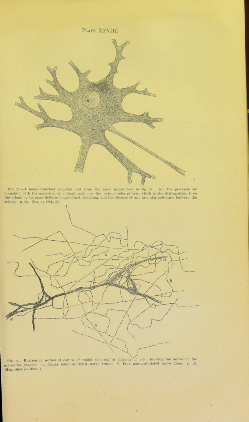 Fig. 72.—A iiiaTiy-branched gaueliviu cell from the same preiuii-atiun as fig. 71. All tbe processes nre brauched, with the exceiJtion of a single imle one—the axis-cylinder process, which is also distinguished from the others by its more delicate loiigitudiniil streaking, and the absence cf any granular subst;mce between the 8trii«;.s. p. 69. (Oc, 3; Obj., 8.) \ Magnified 300 diaui.)