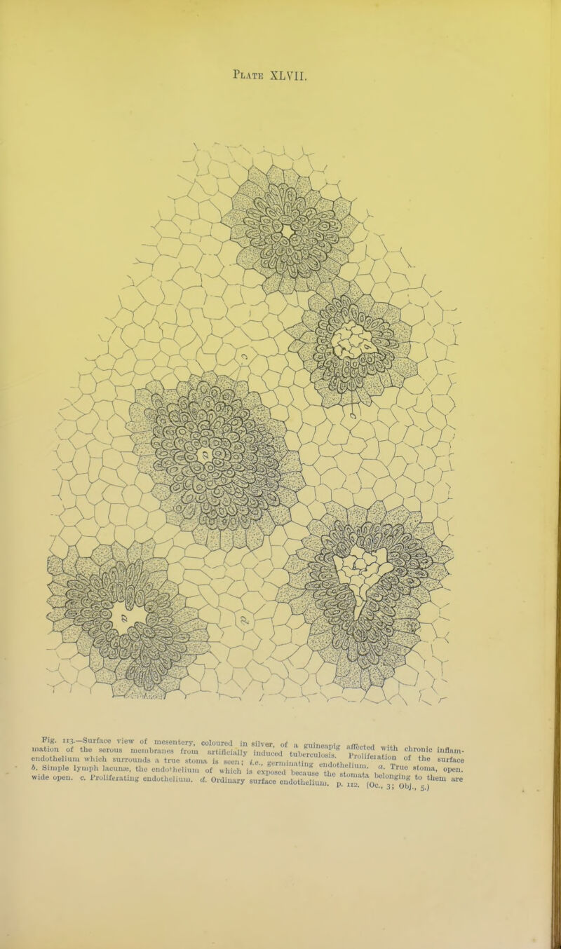 Fig. 113.—Surface view of mesentery, coloured in silvor ,. ™-, < ™ .nation of the serous meu.bn.nes TmiZ uZc.^^^ Tif ifl«...- e,Klotheliu,u w.,io.. surrounds a true .^J17^^.^^^:^.--.life.ation of t),e surface b. Snnvle lynph lac.nue, the endo.l,eliu,n of which i expol^ r^^^^^^^^^^^ ^'^