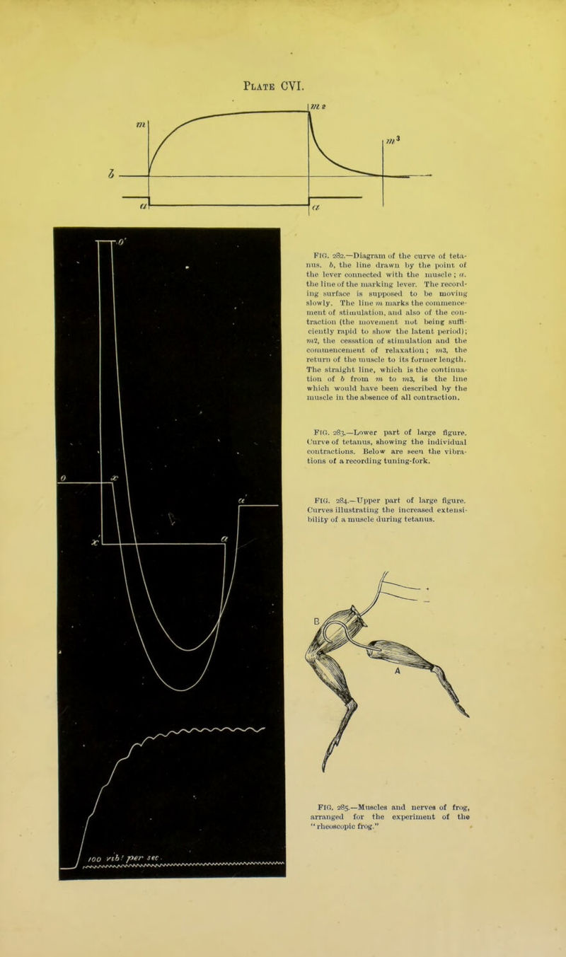 Flf!. 282.—Diagram uf the curve of tetii- ims. 6, the line drawn by tlie pciint o( tlio lever connected witli tlie muaele; a. tlie line of tlie nKirkiuK lever. The record- ing snrfaee is supposed to lie moving slowly. The line m marks the commence- ment uf stiuiulatiun, ami also of the eon- traction (the movement nut )>eing suiti- eiently rapid Ui show the latent ptiriod); m'i^ the cessation of Btimulation and the commencement of relaxation; ?»3, the return of the muscle to its former length. The straight line, which is the continua- ti(»ii uf b from vi to ?»3, is the line which would have l>een described by the muscle in the absence o( all cuutraction. Fk:. 283.—Lower part of large figure, t'urve of tetfinus, showing the individual contractions. Below are seen the vibra- tions of a recording tuning-fork. Plf(. 284.—Upper x>Mt of large figure. Curves illustrating the increjised extensi- bility of a muscle during tetanu.s. FIO. 285.—Muscles and nerve* of frog, arranged for the experiment of the  rheoBcopic frog. /OO vib! per sec